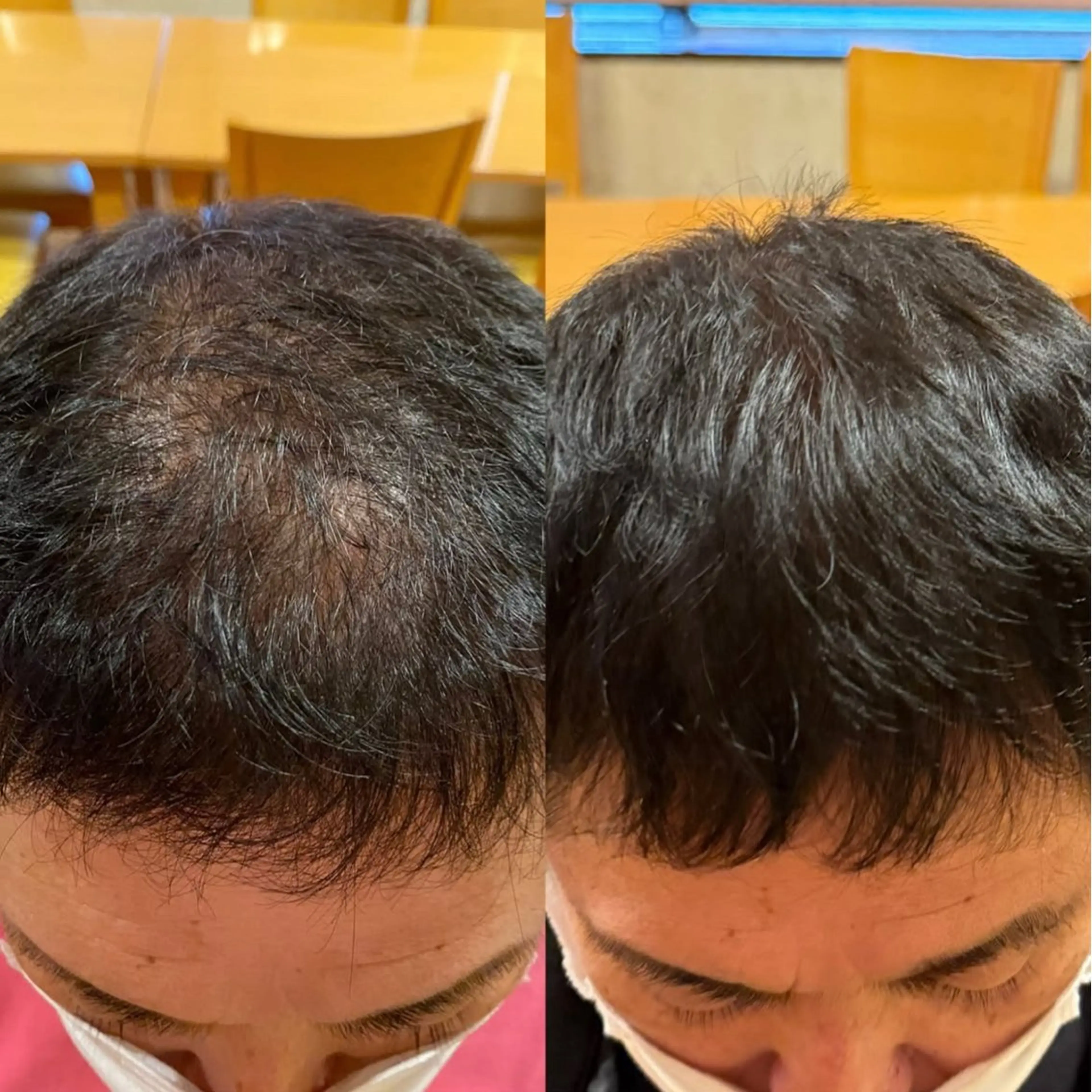 Blooming所属・LOUISE. ／肌質・頭皮のエステ・リラクイメージ