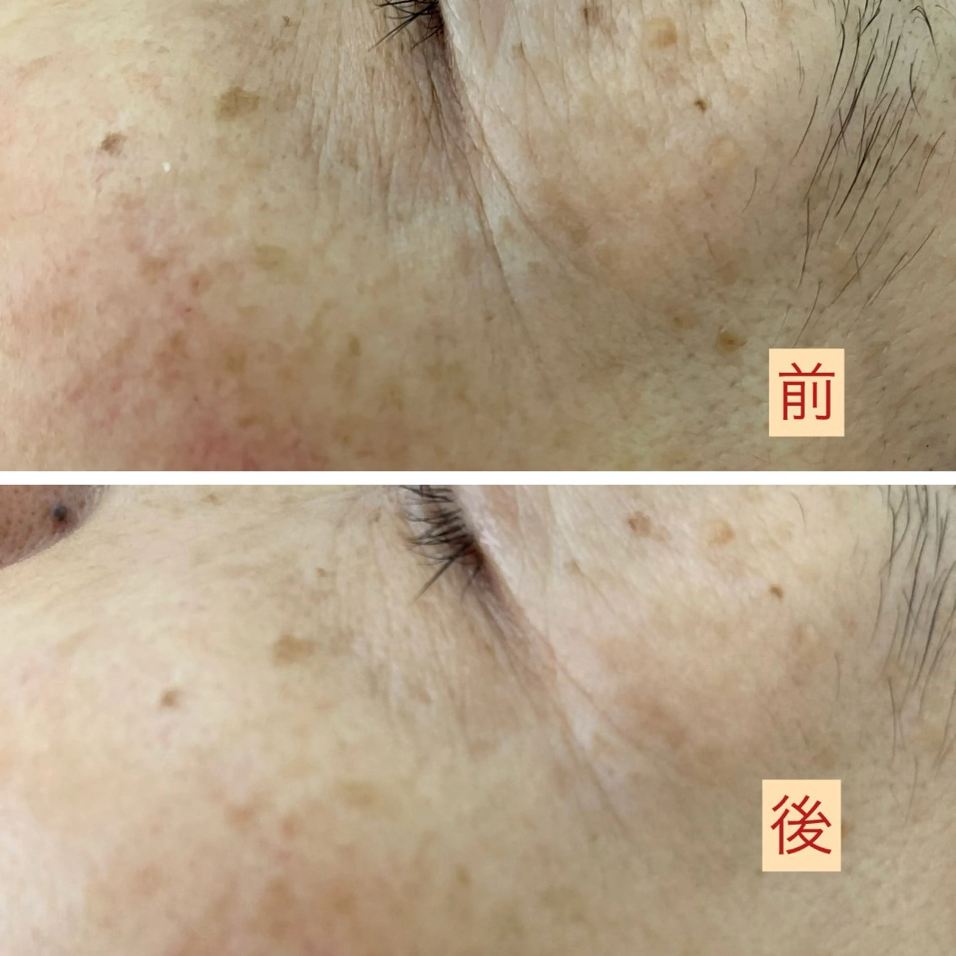 たるみ改善小顔エステ 堀葉月のその他イメージ