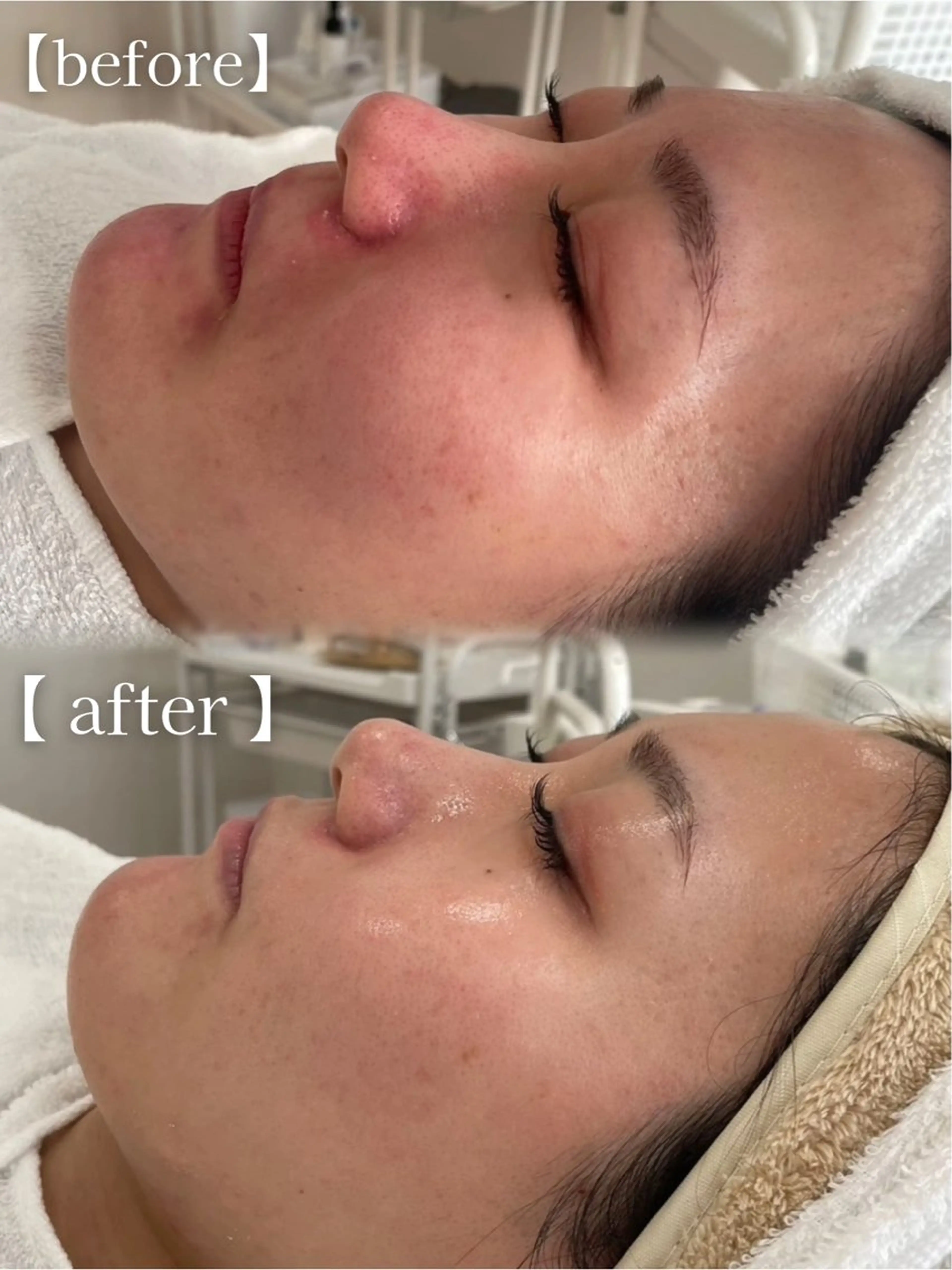 URARA 【lazo】のマツエク・マツパデザイン