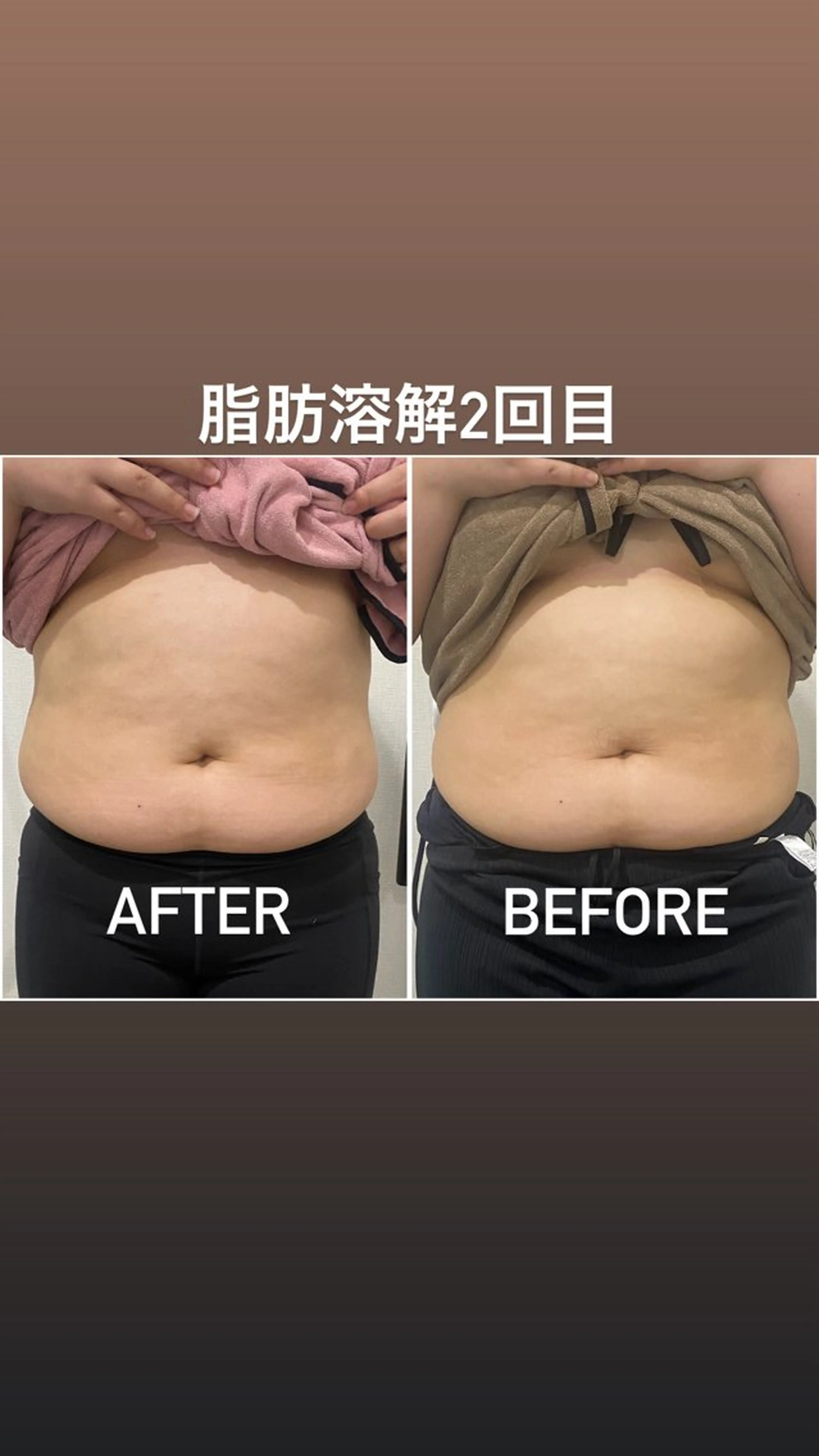 エステ 毛穴洗浄・痩身・脱毛 /アルカンジュのエステ・リラクイメージ