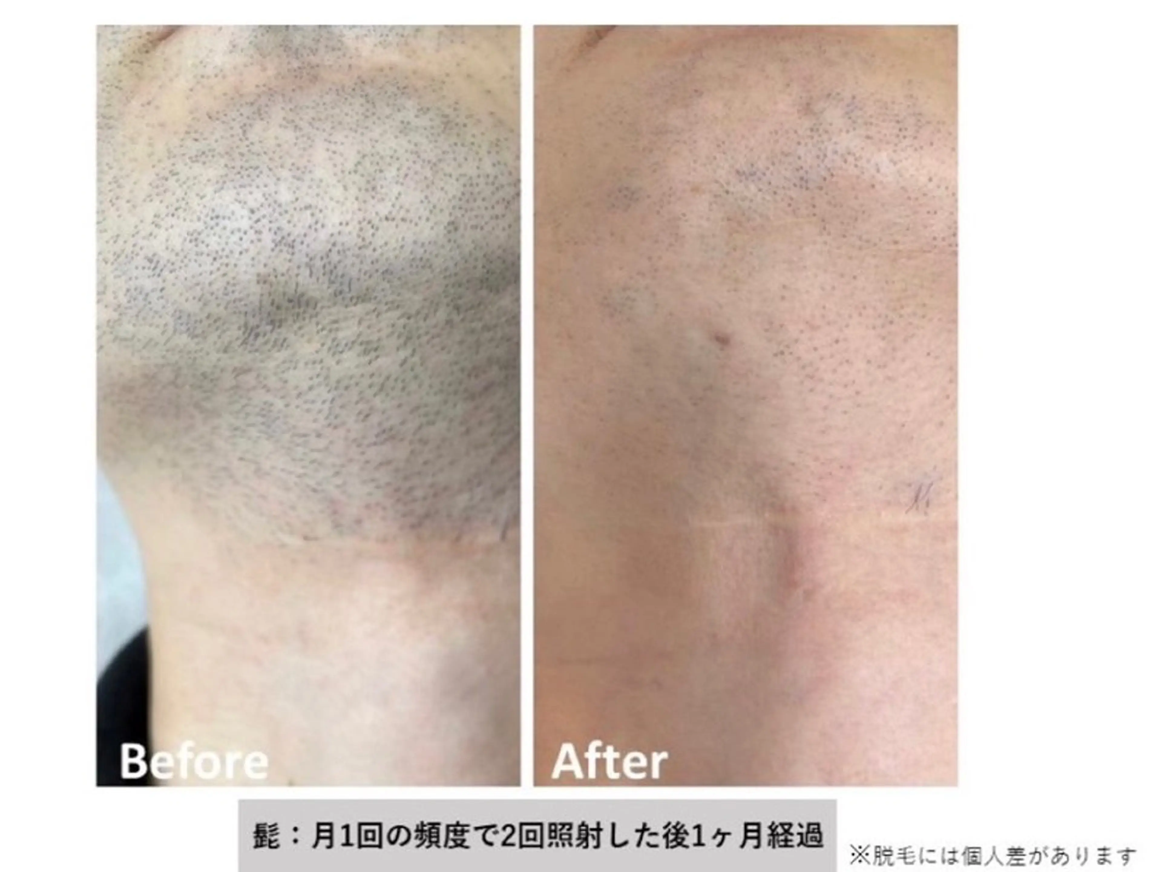 エステサロンさら所属・エステサロン さらのエステ・リラクイメージ