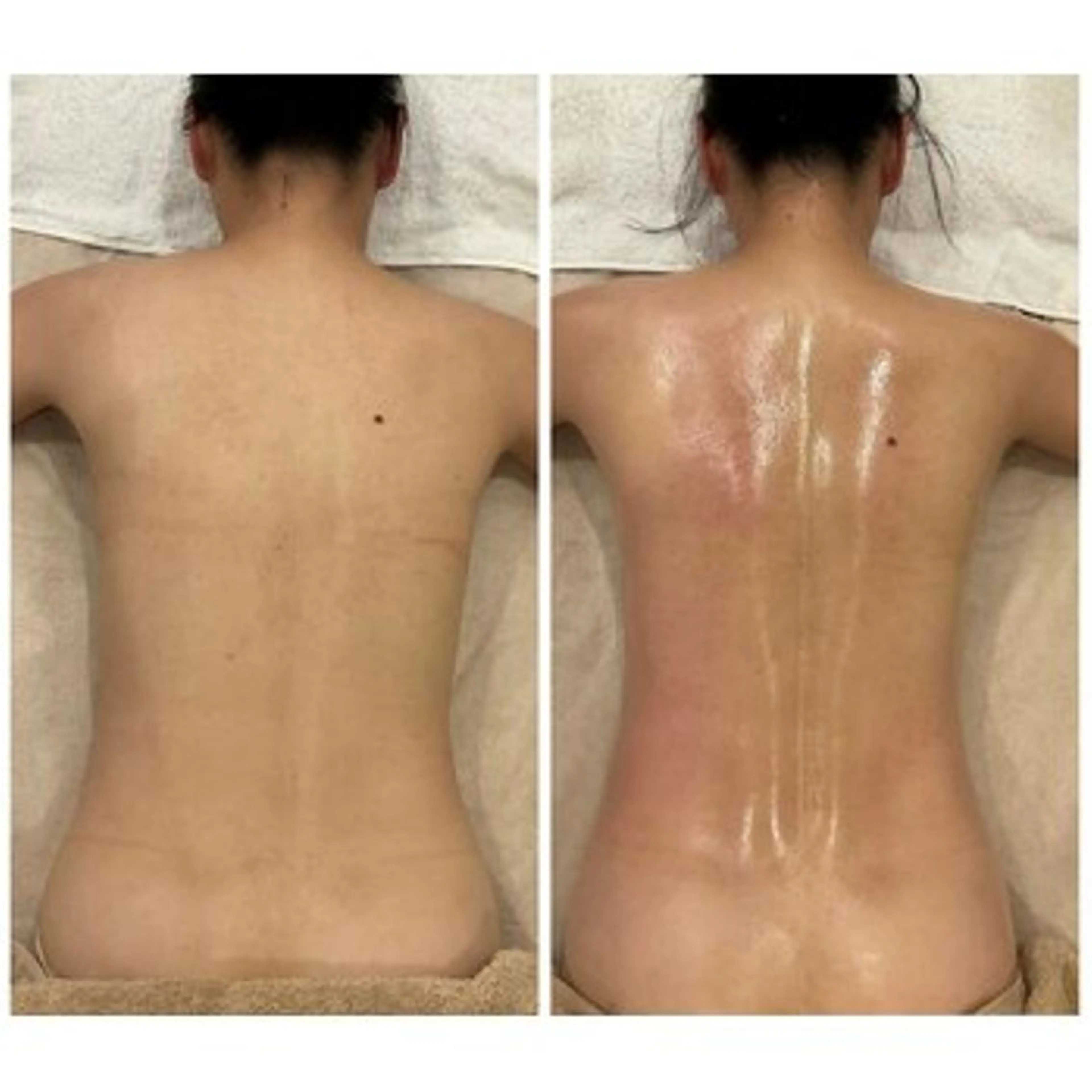 痩身&小顔サロン LilyAsのエステ・リラクイメージ