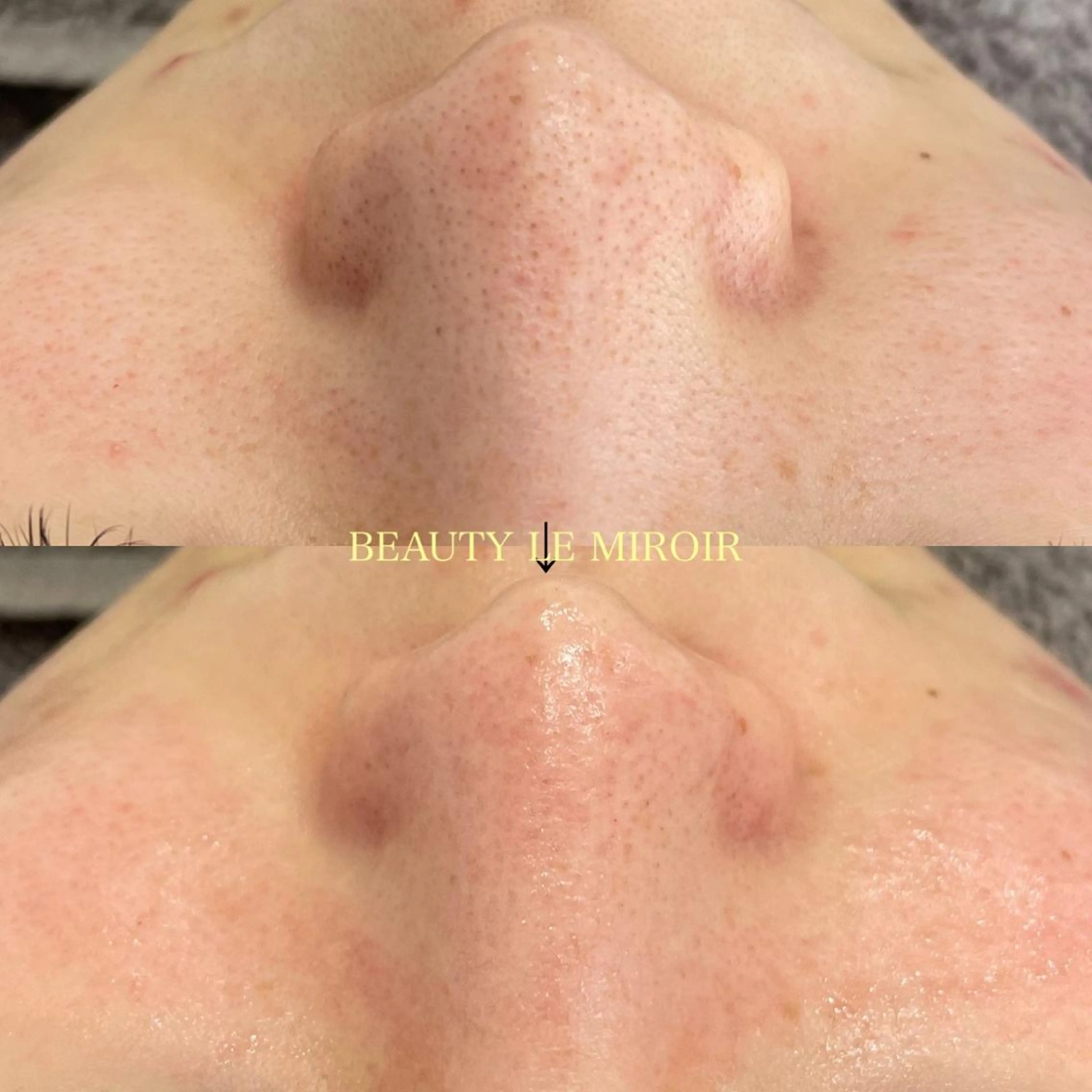 ビューティー ミロワールのエステ・リラクイメージ