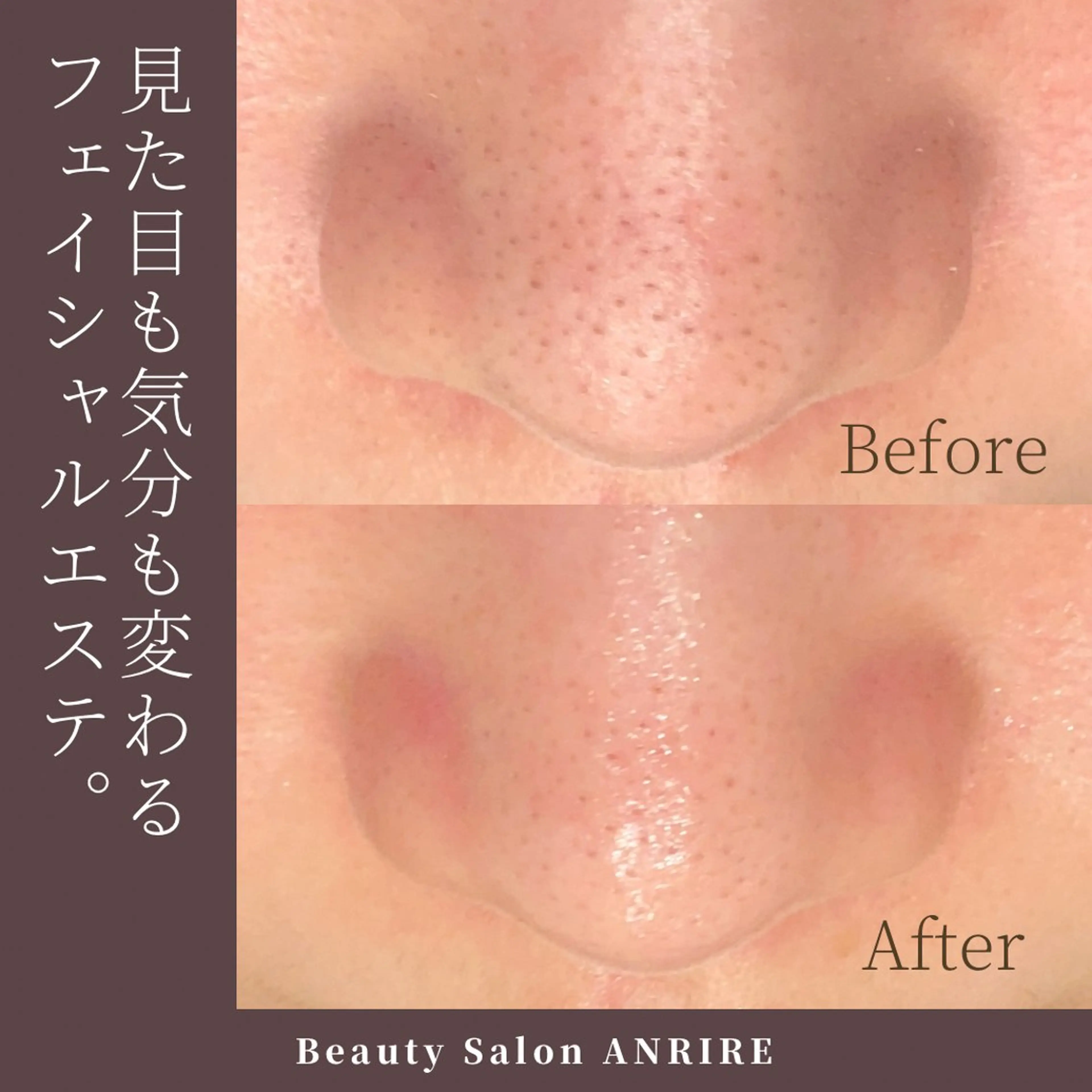 ANRIRE (アンリール)のエステ・リラクイメージ