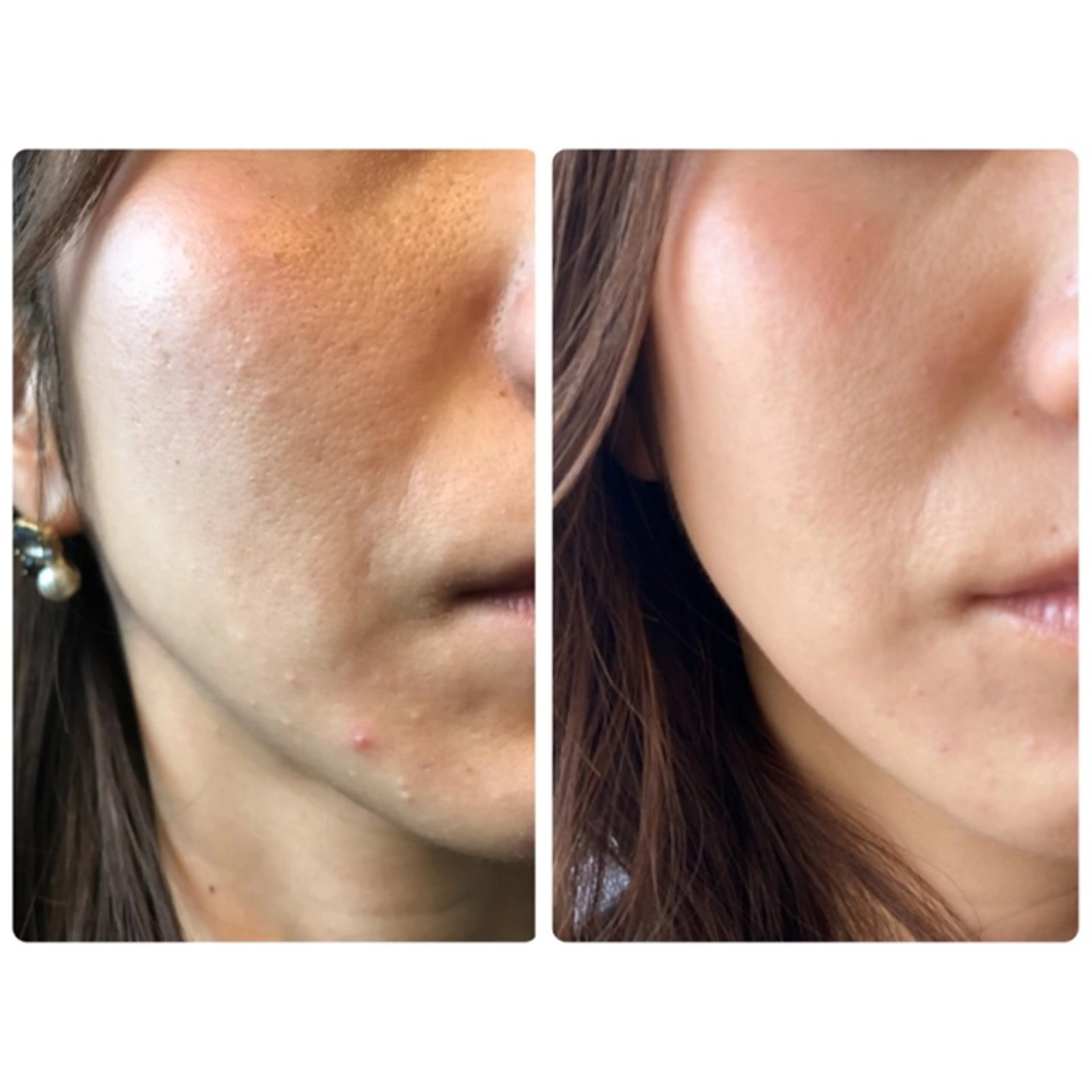 その他 上野 伊久美のその他イメージ