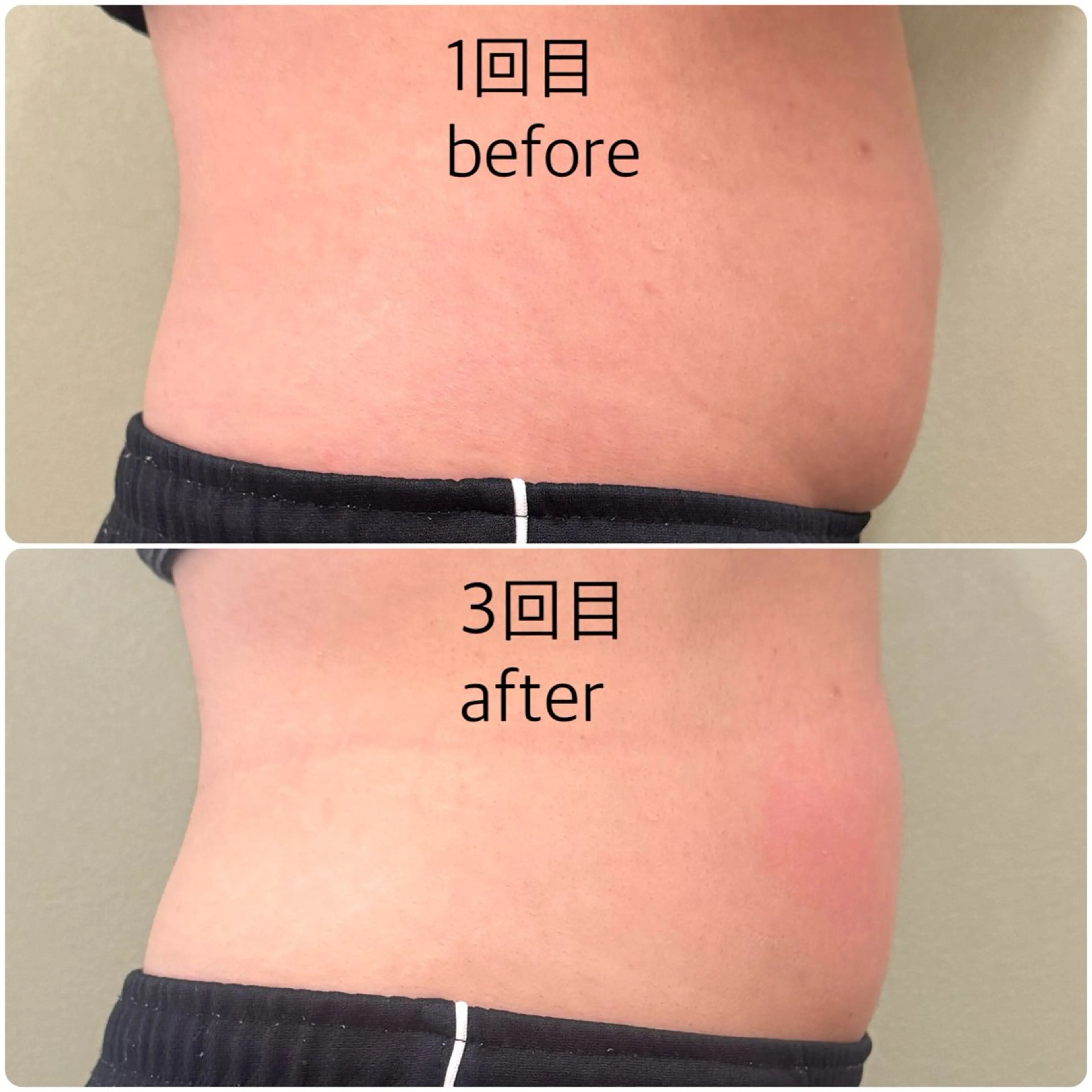 【メンズにも人気】ぽっこりお腹解消コースの写真