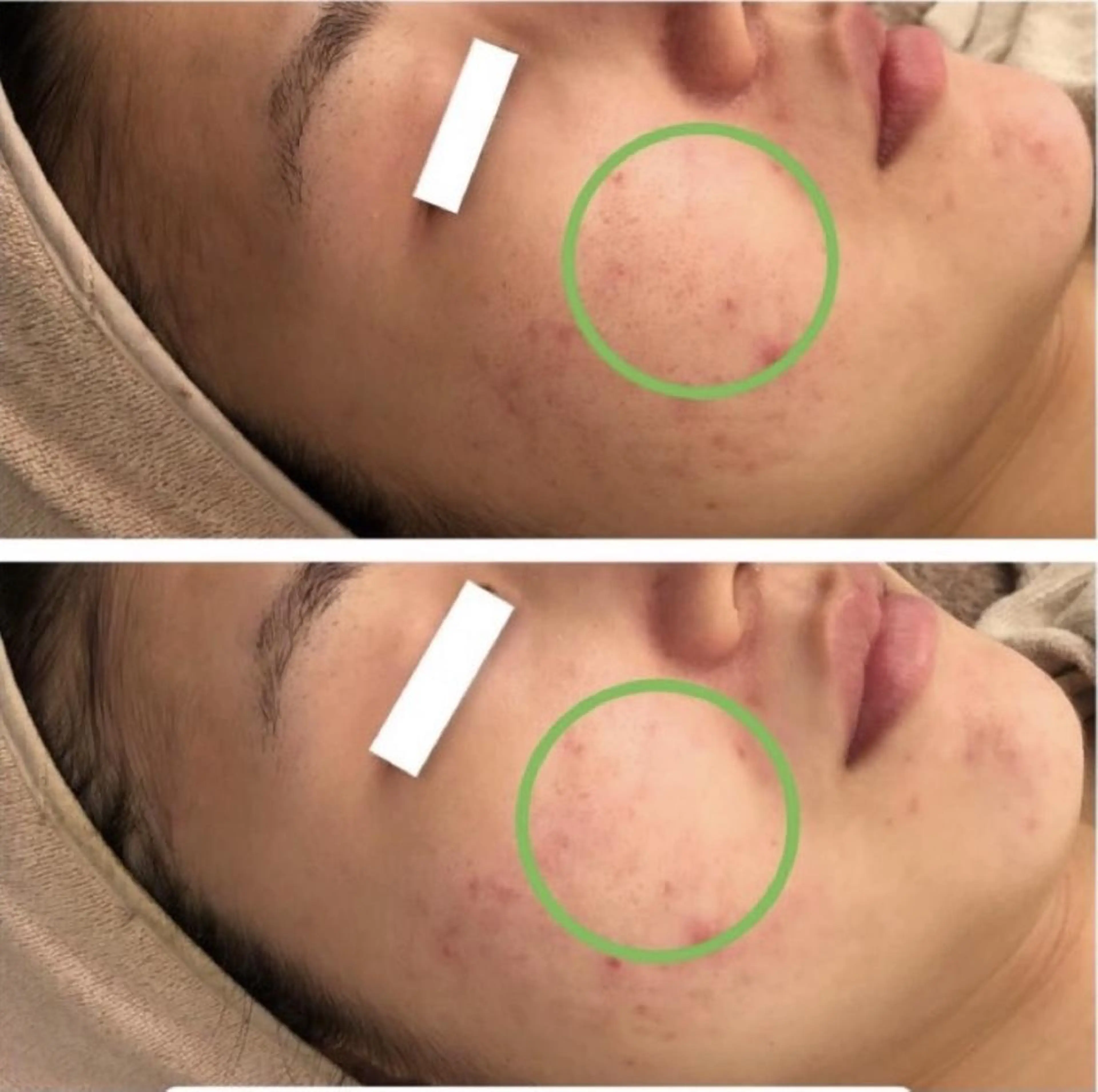 ✨美肌水光✨ アトリエリュバンのエステ・リラクイメージ