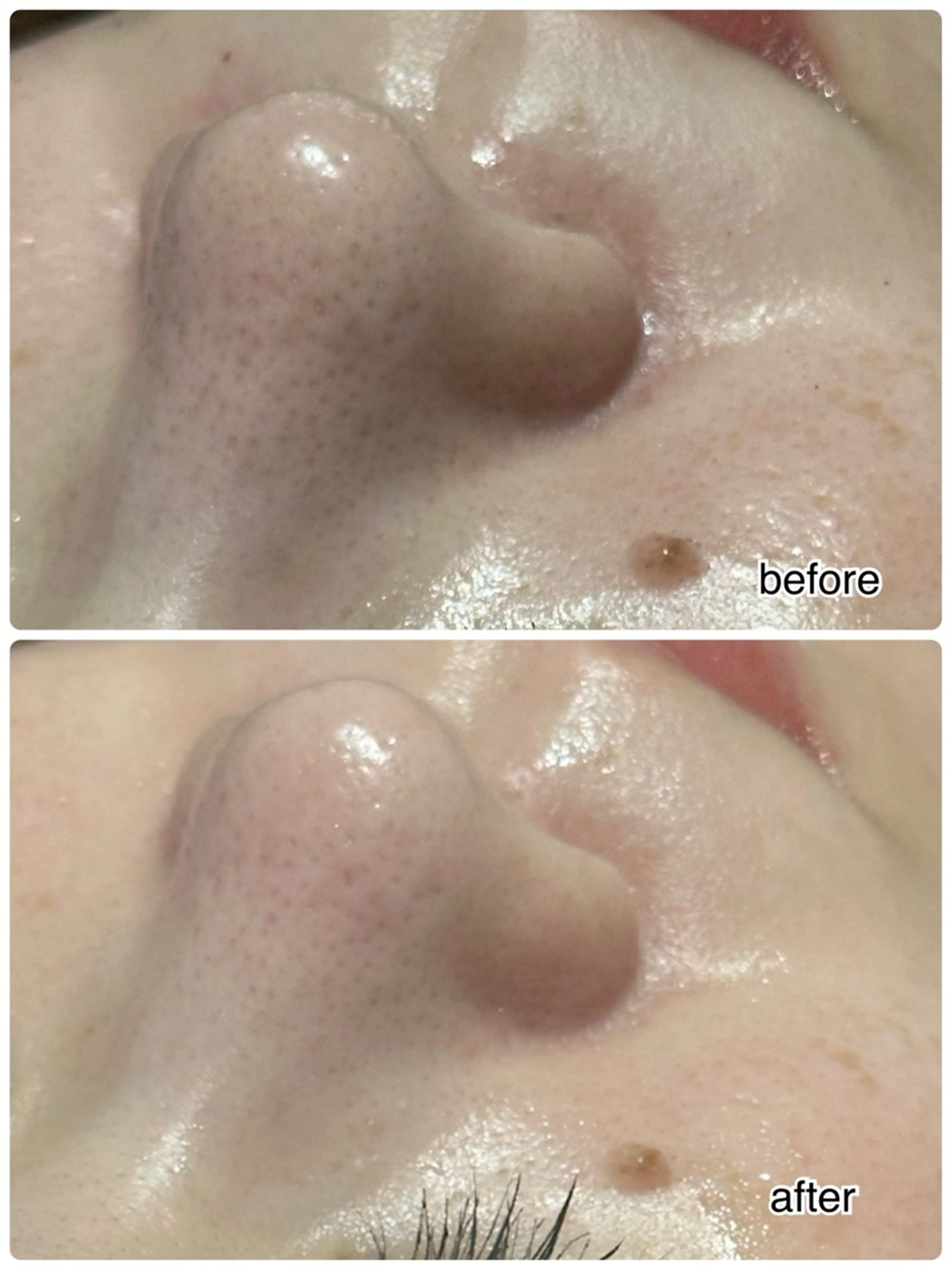 エステ ENCHANT 脱毛.小顔.毛穴のエステ・リラクイメージ