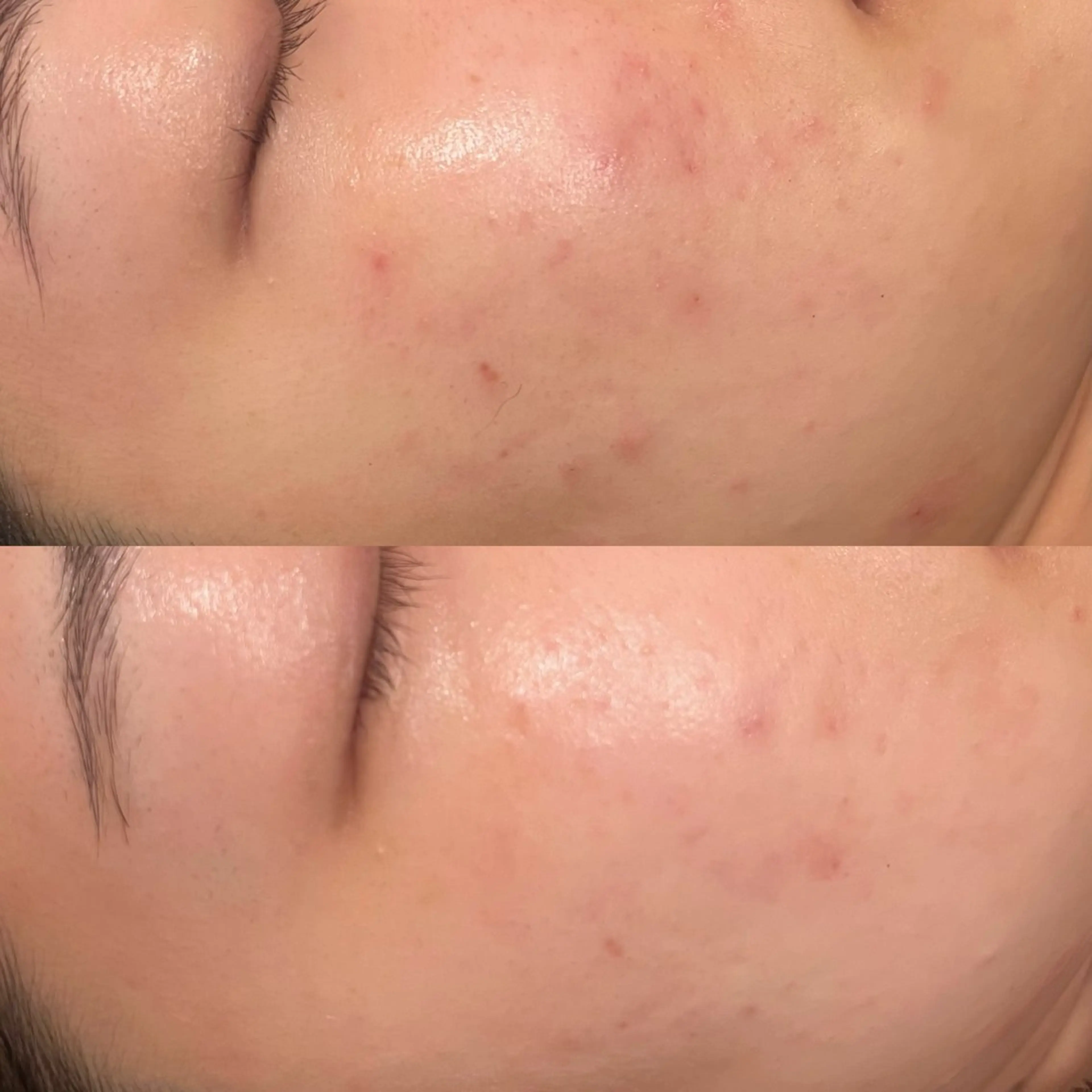 エステ リラク TRUE CARE所属・ハーブピーリング/ 上本町/美肌/幹細胞のエステ・リラクイメージ