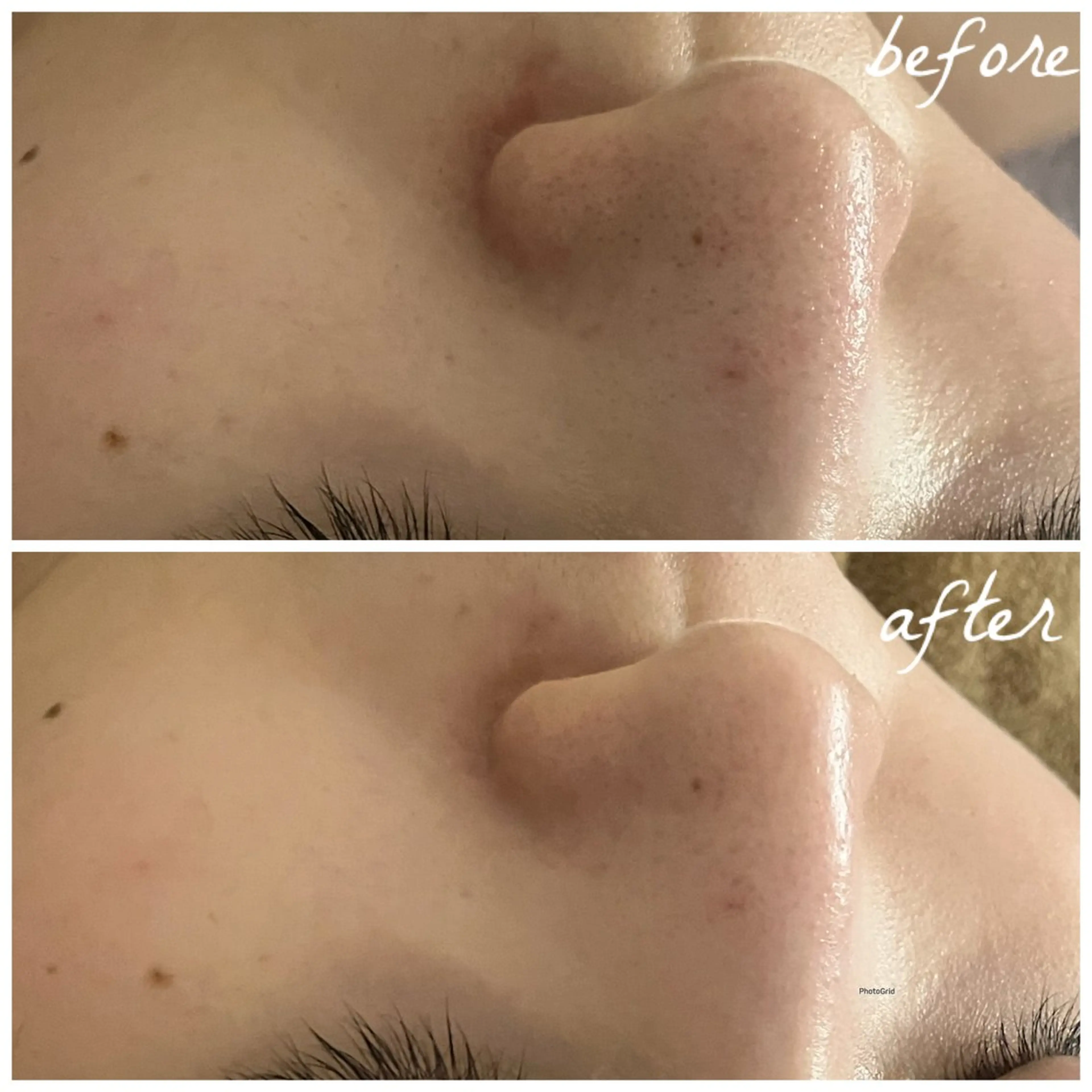 メンズ エステ メナード岐阜茜部 杉浦のエステ・リラクイメージ