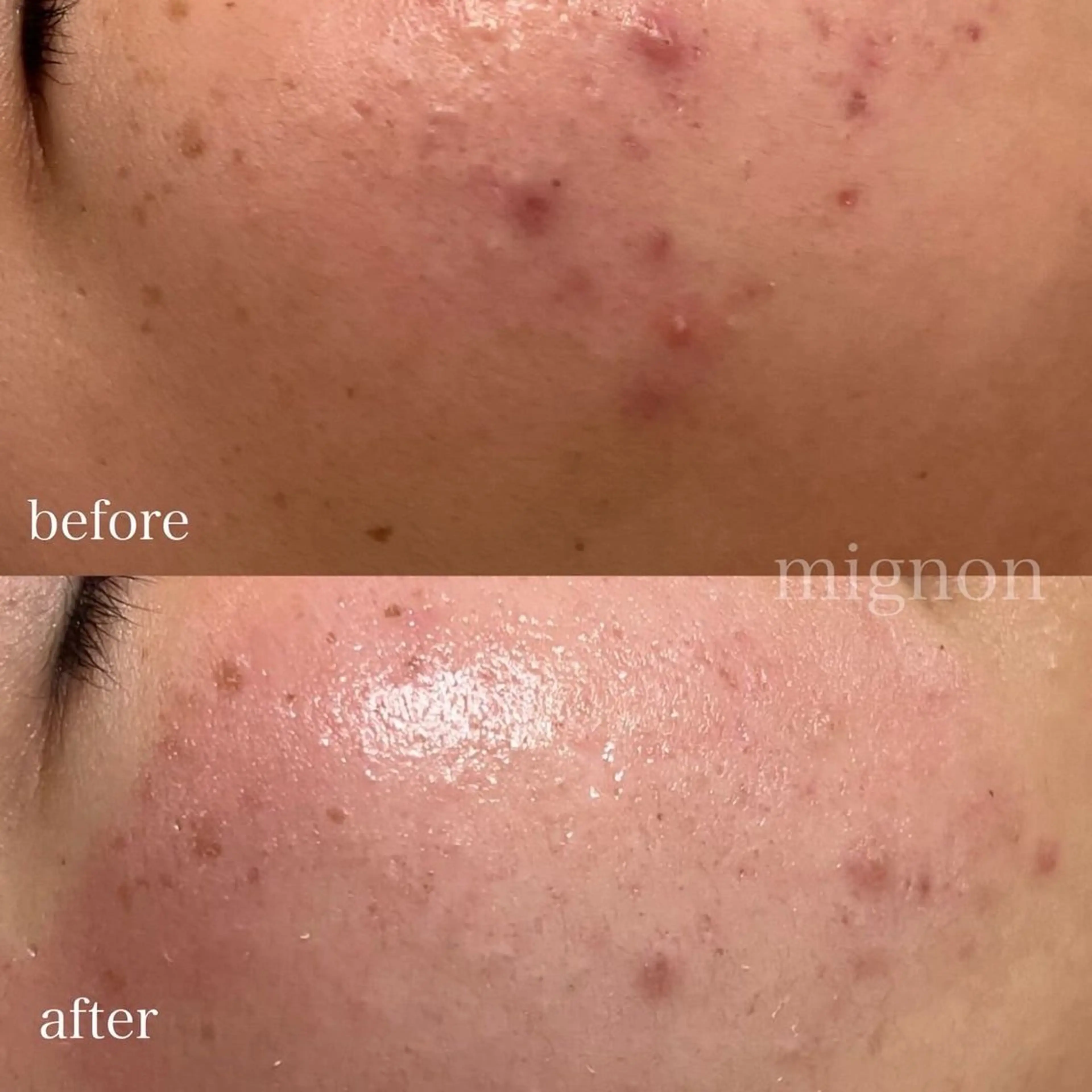 、 、‪‪のエステ・リラクイメージ