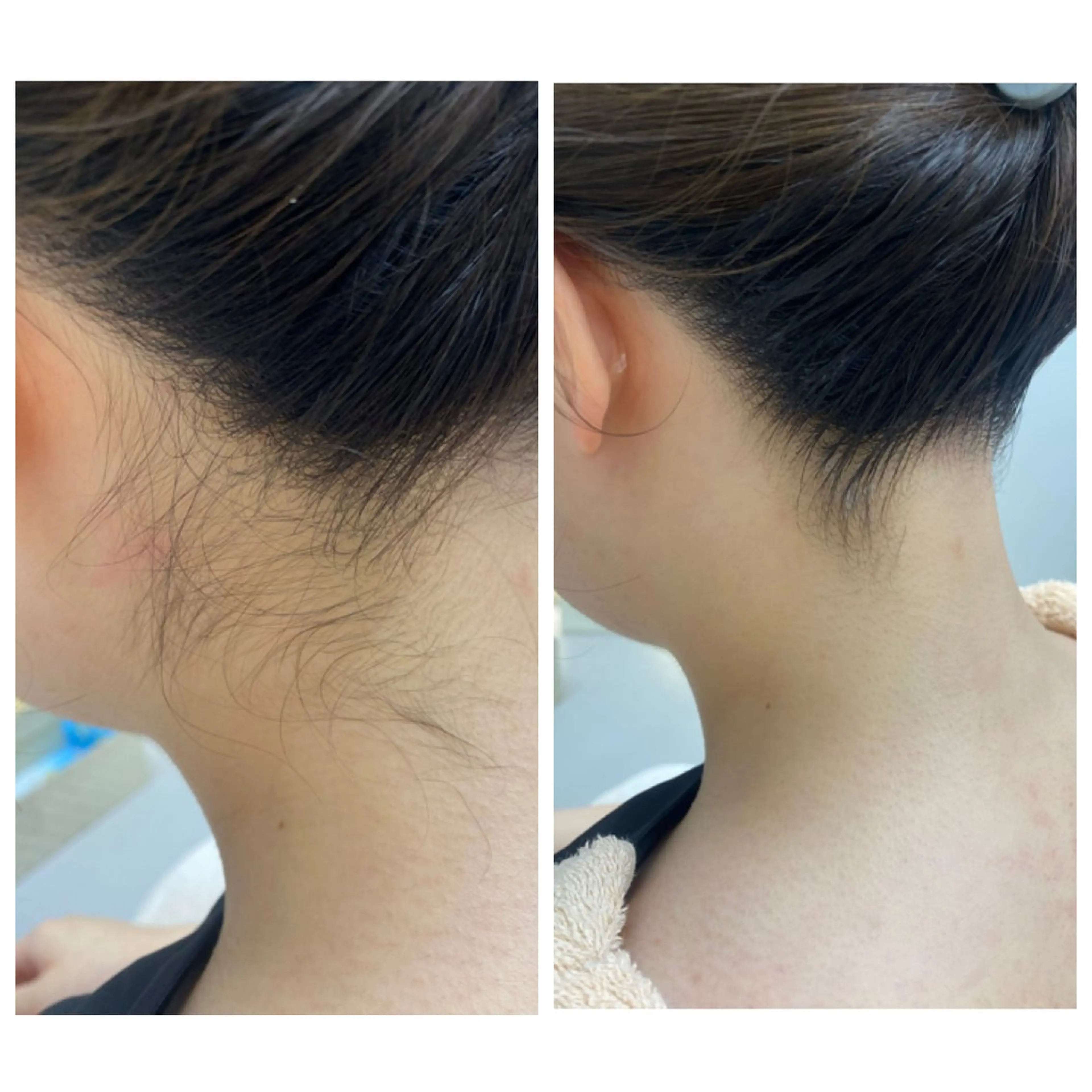 シェービングサロン ブランジュのエステ・リラクイメージ