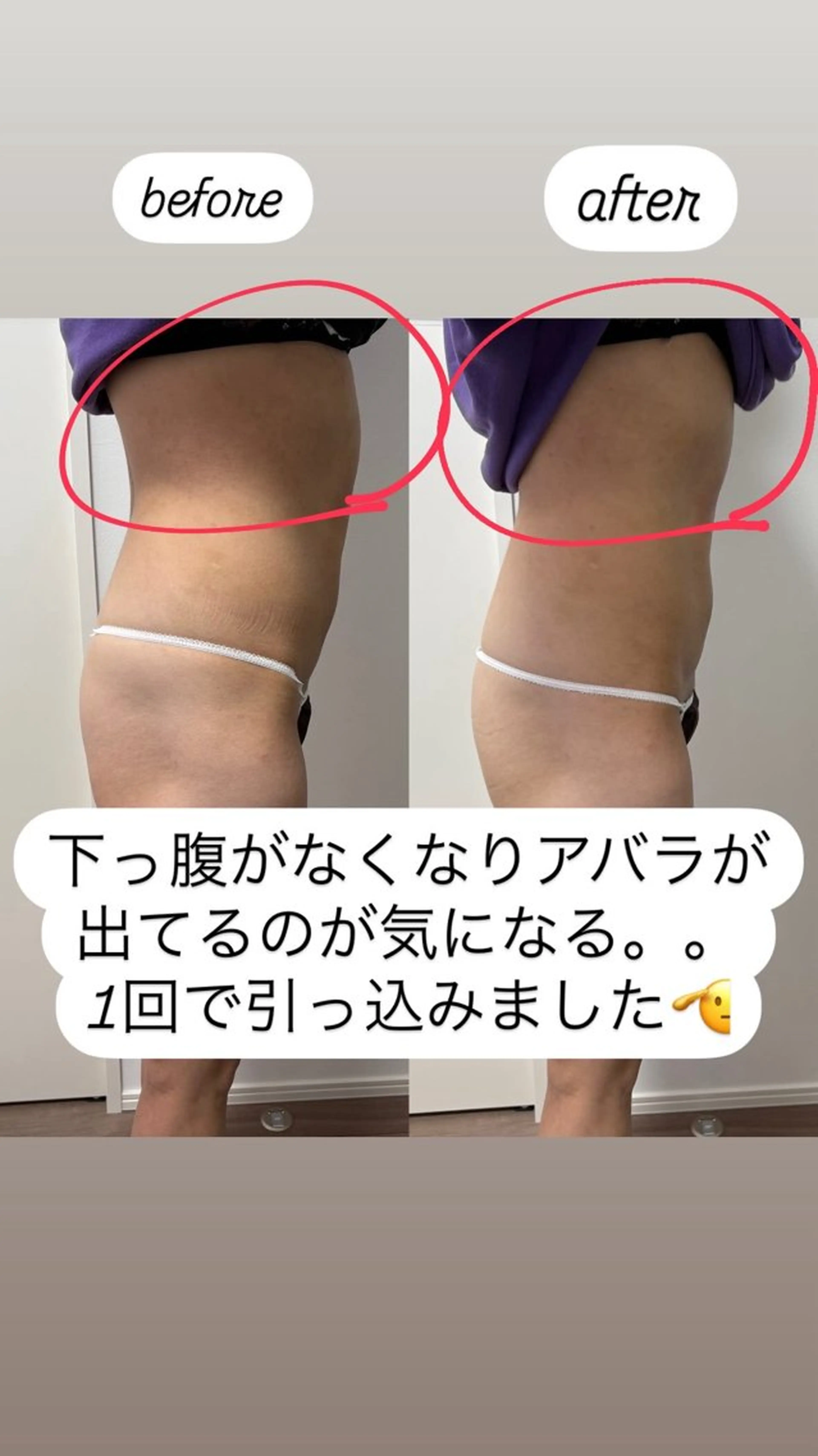 エステ Miiju.所属・Miiju. 石巻市 脂肪冷却  鈴木のエステ・リラクイメージ