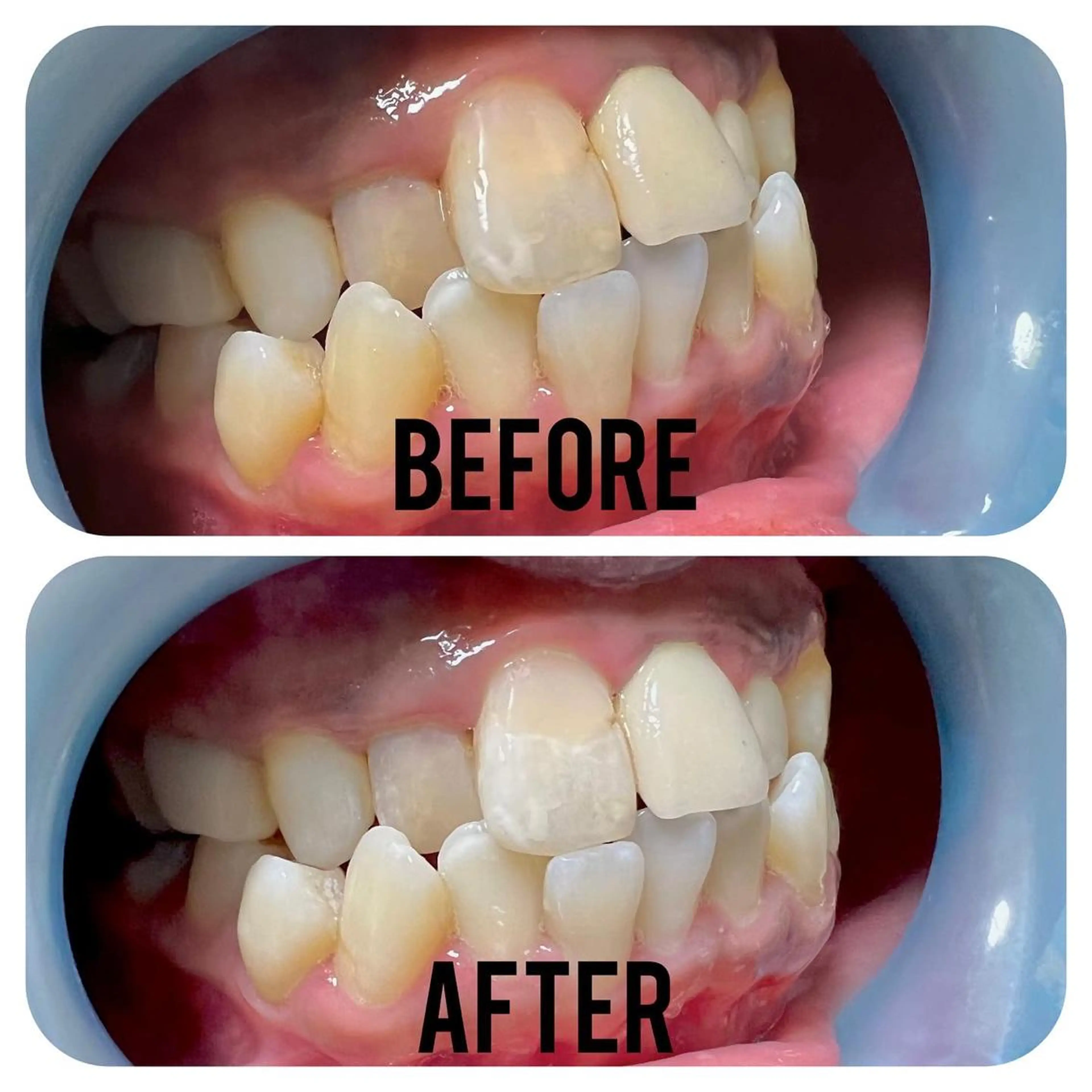 その他 two nailのネイルデザイン