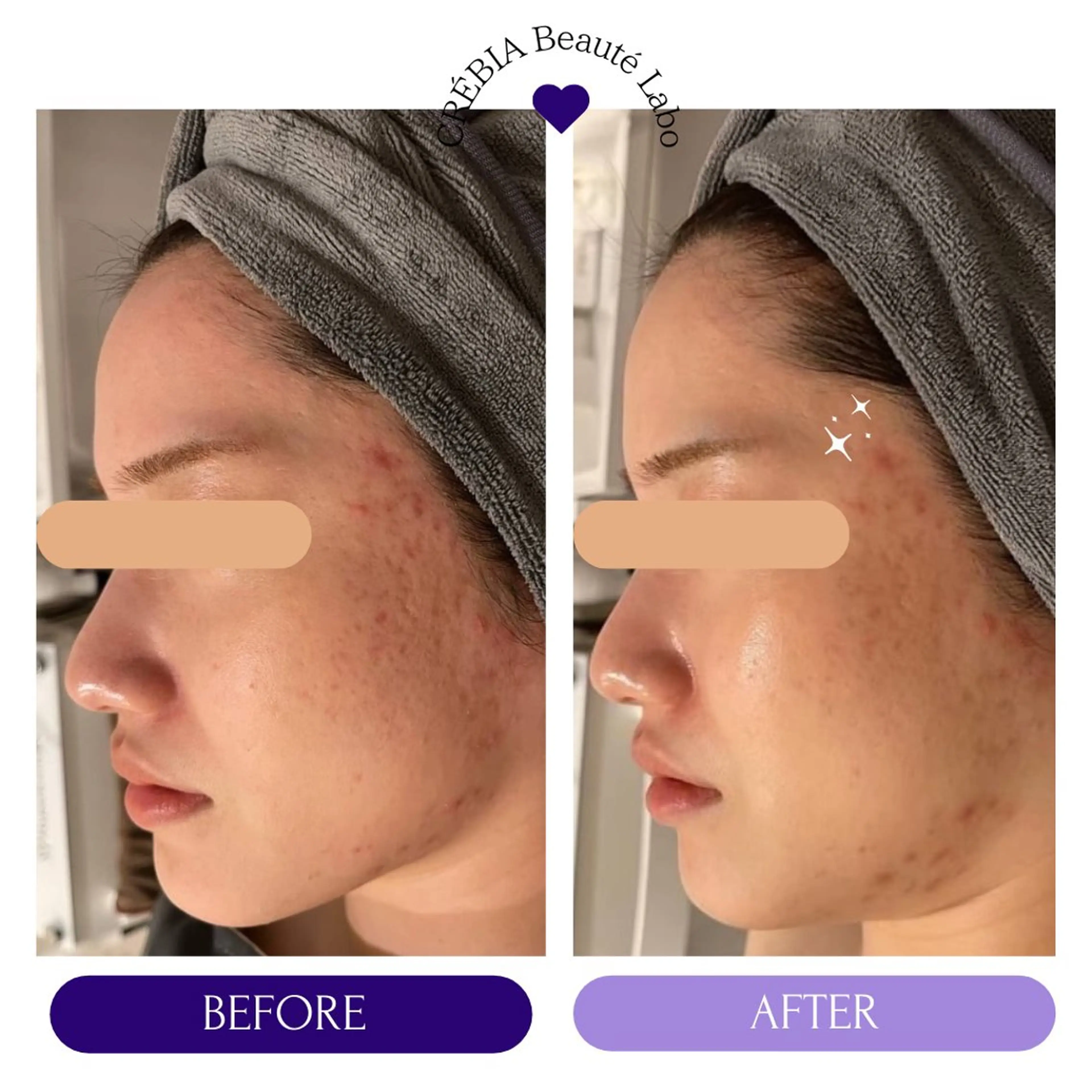 エステ 小顔＆まつ毛サロン AKANE❤️のエステ・リラクイメージ