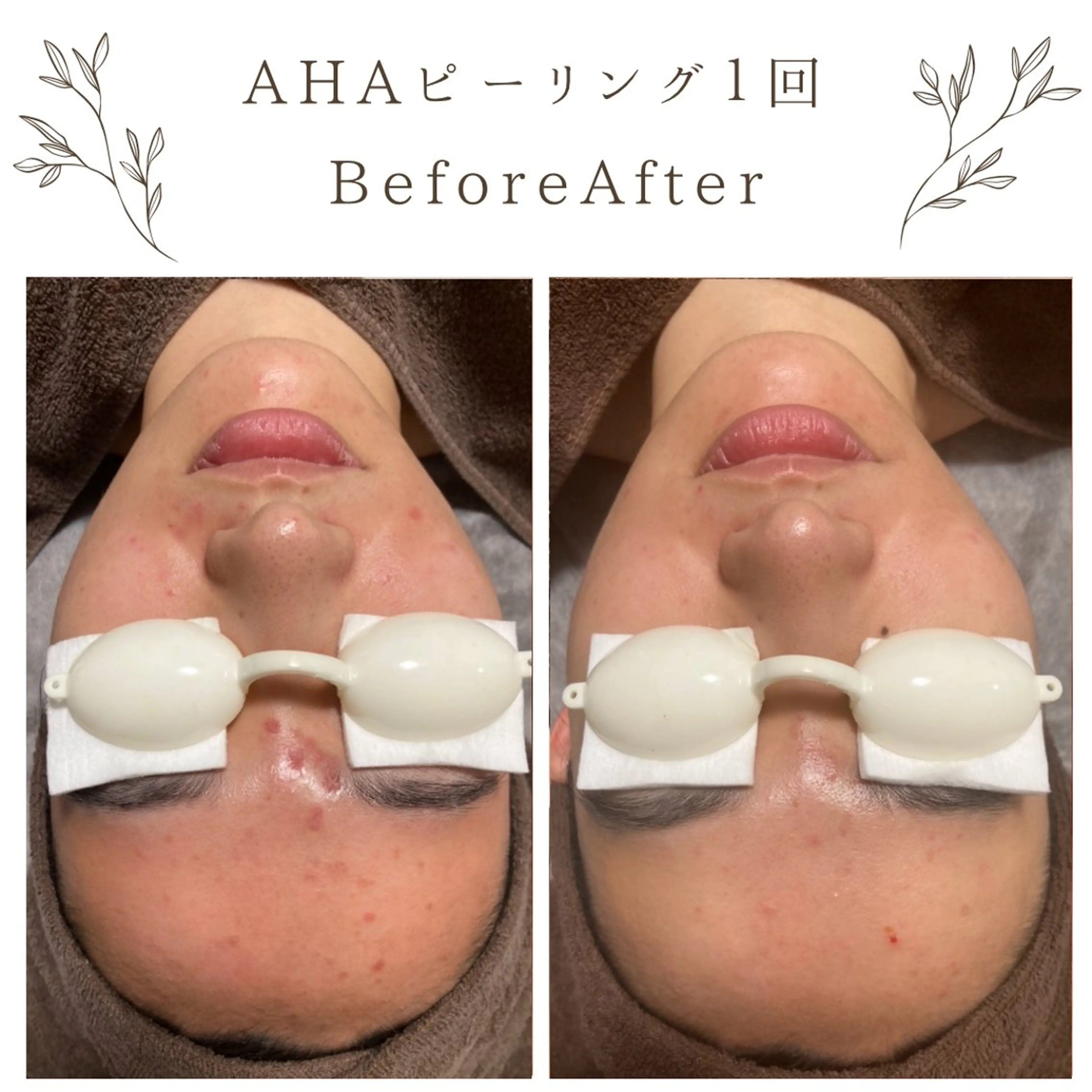 な ぎのエステ・リラクイメージ