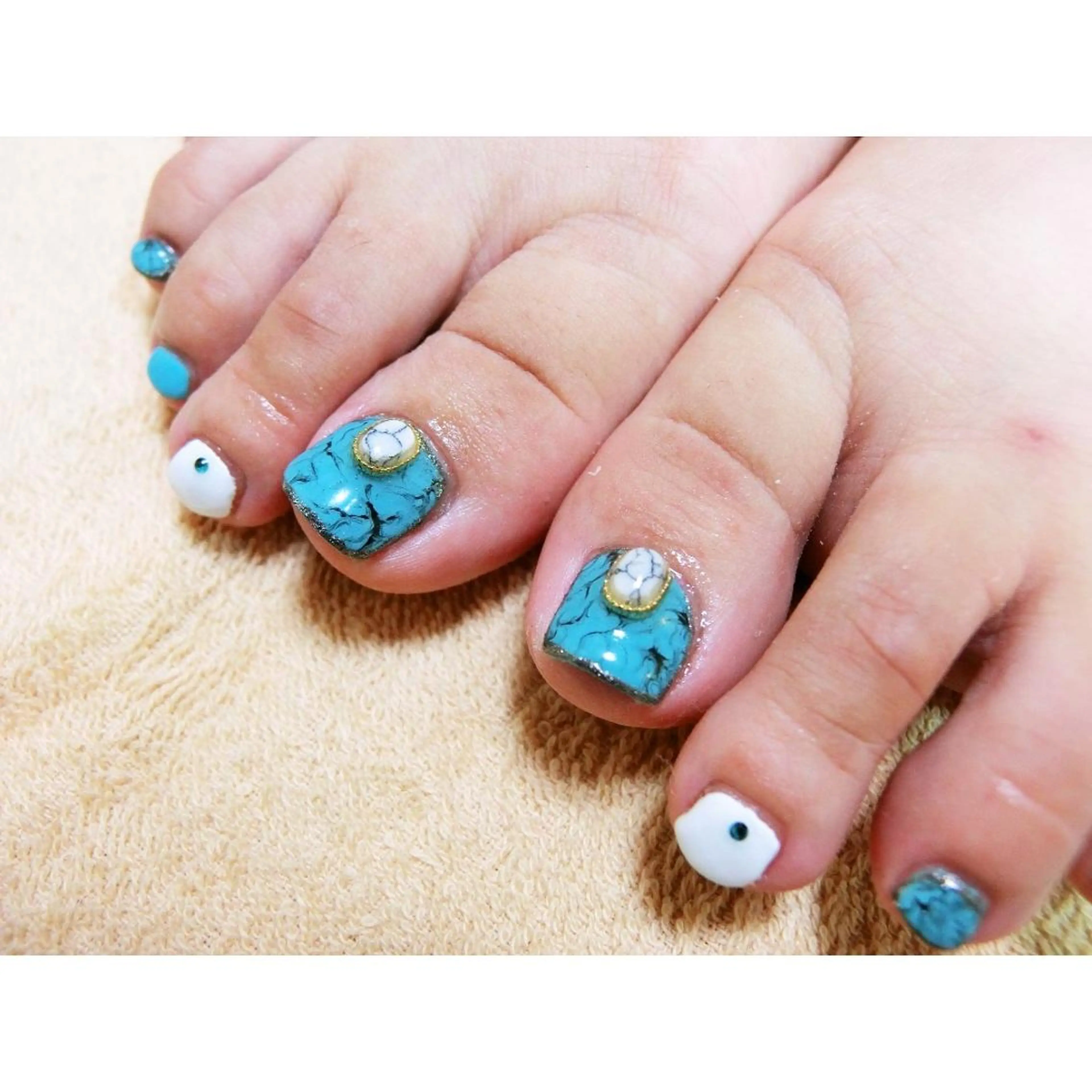 ネイル フットネイル 痛ネイル/ワンホン/ フィルイン/長さだしのネイルデザイン