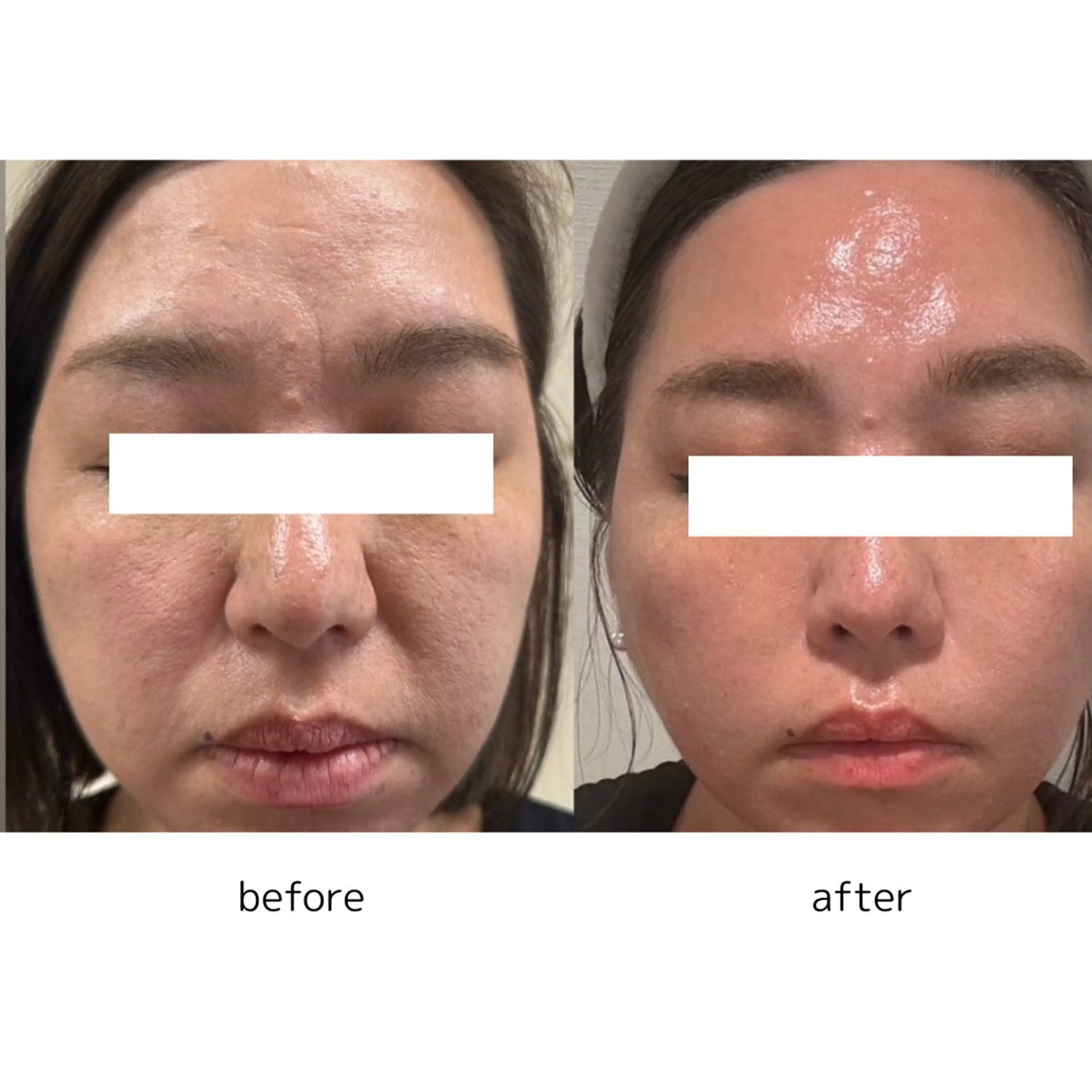 EMININAL salon所属・鈴木 映子のエステ・リラクイメージ