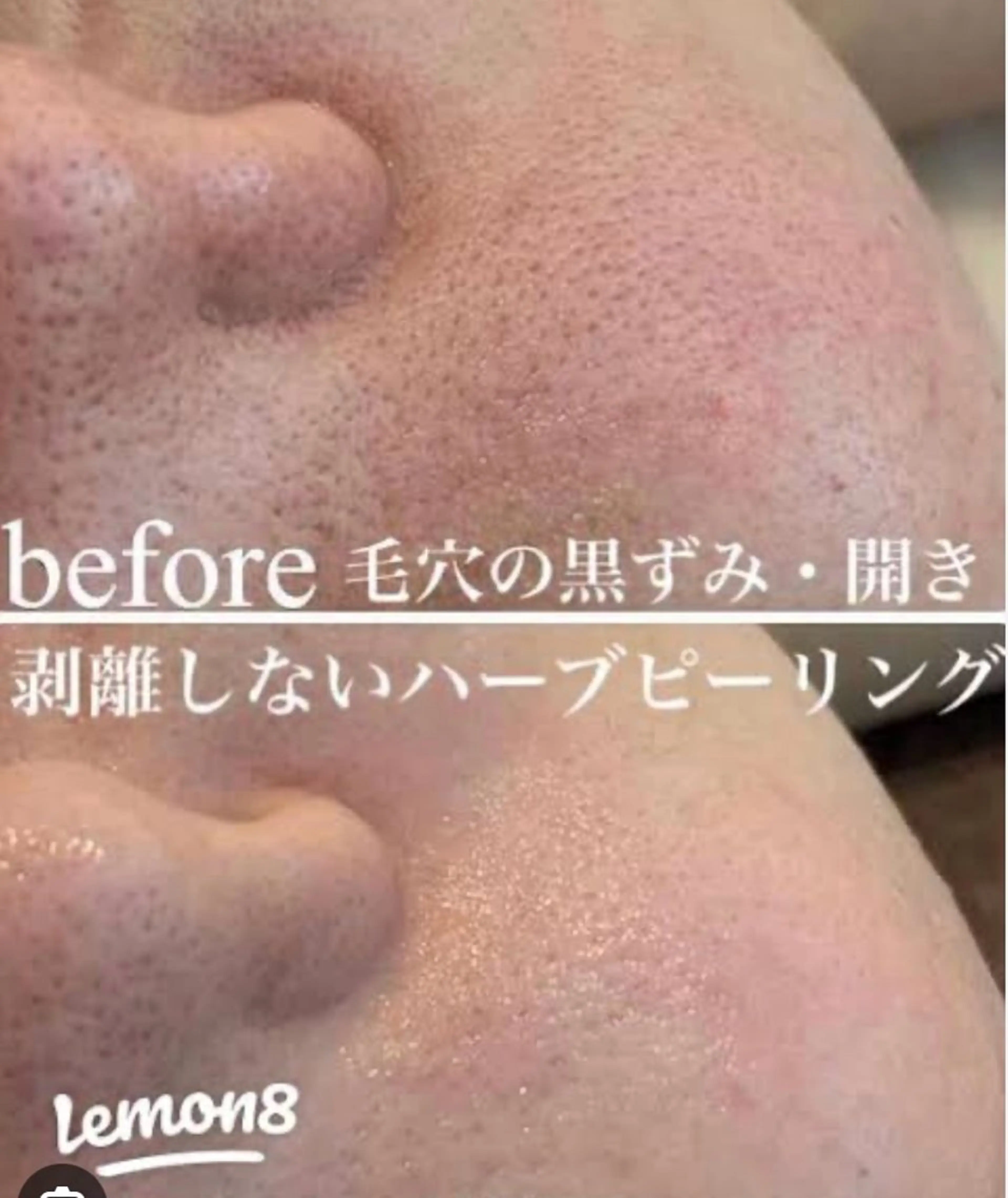 美BELLO 池袋のエステ・リラクイメージ