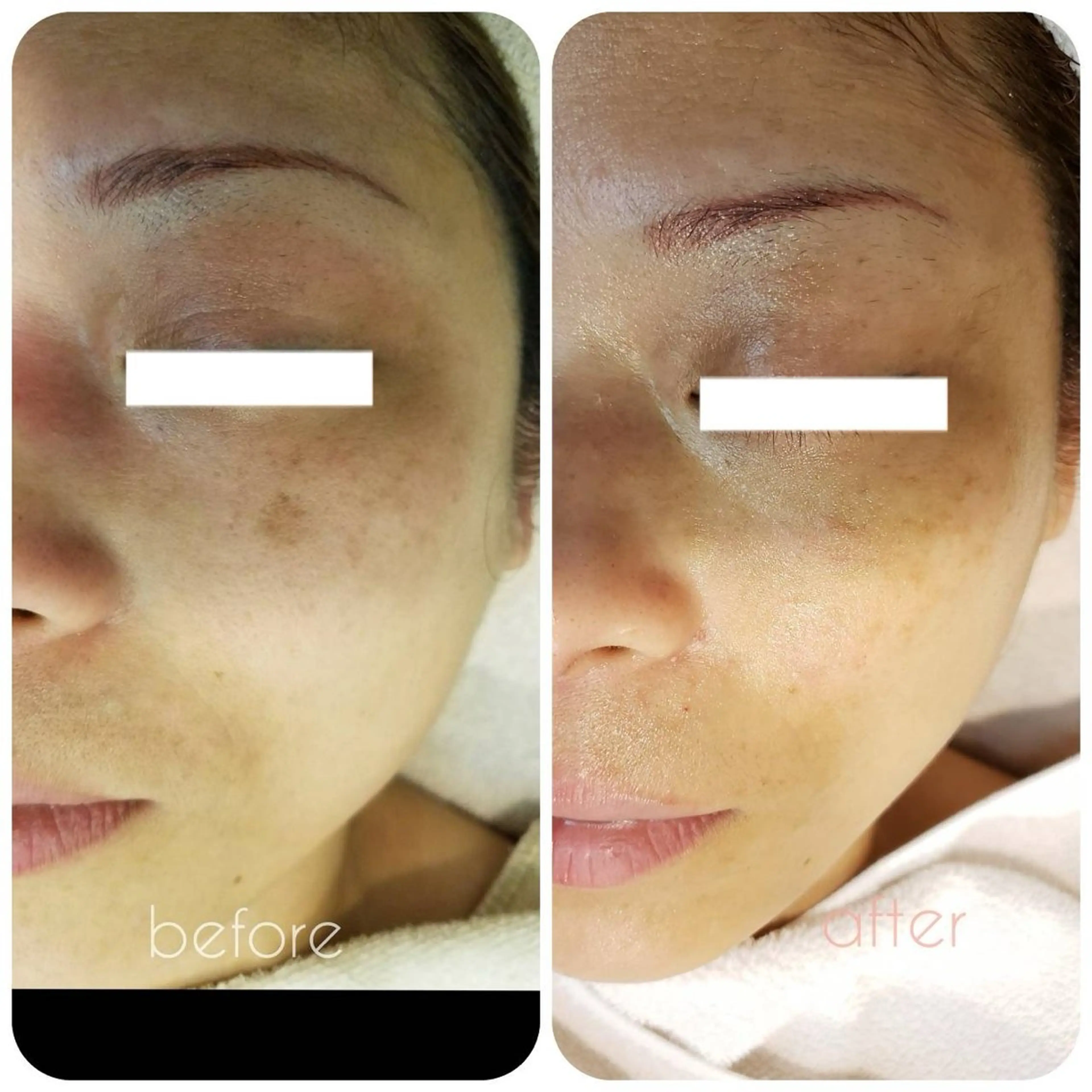 エステ N.style所属・Ｎ. styleのネイルデザイン