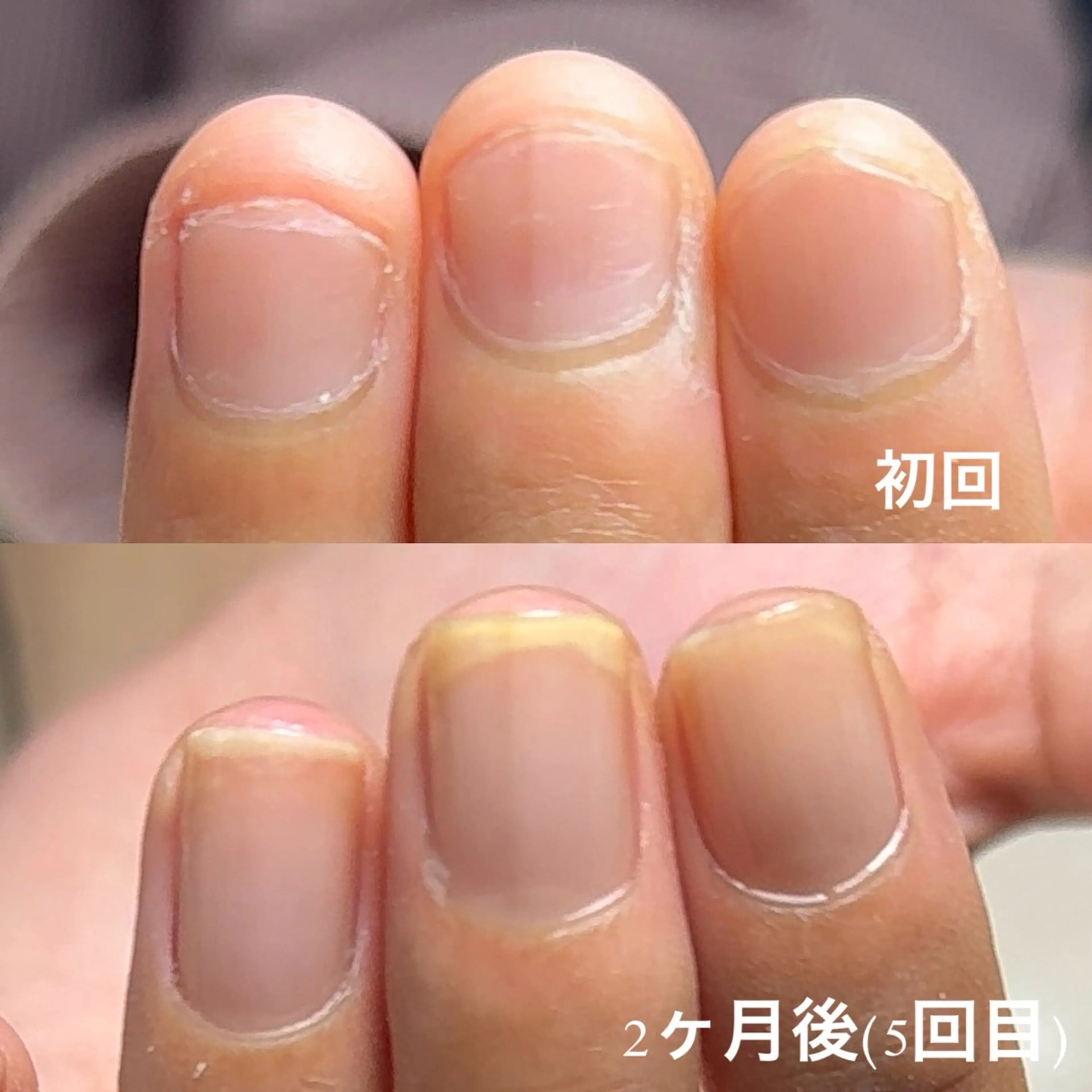 ネイル Aim* 深爪・自爪育成専門店のネイルデザイン