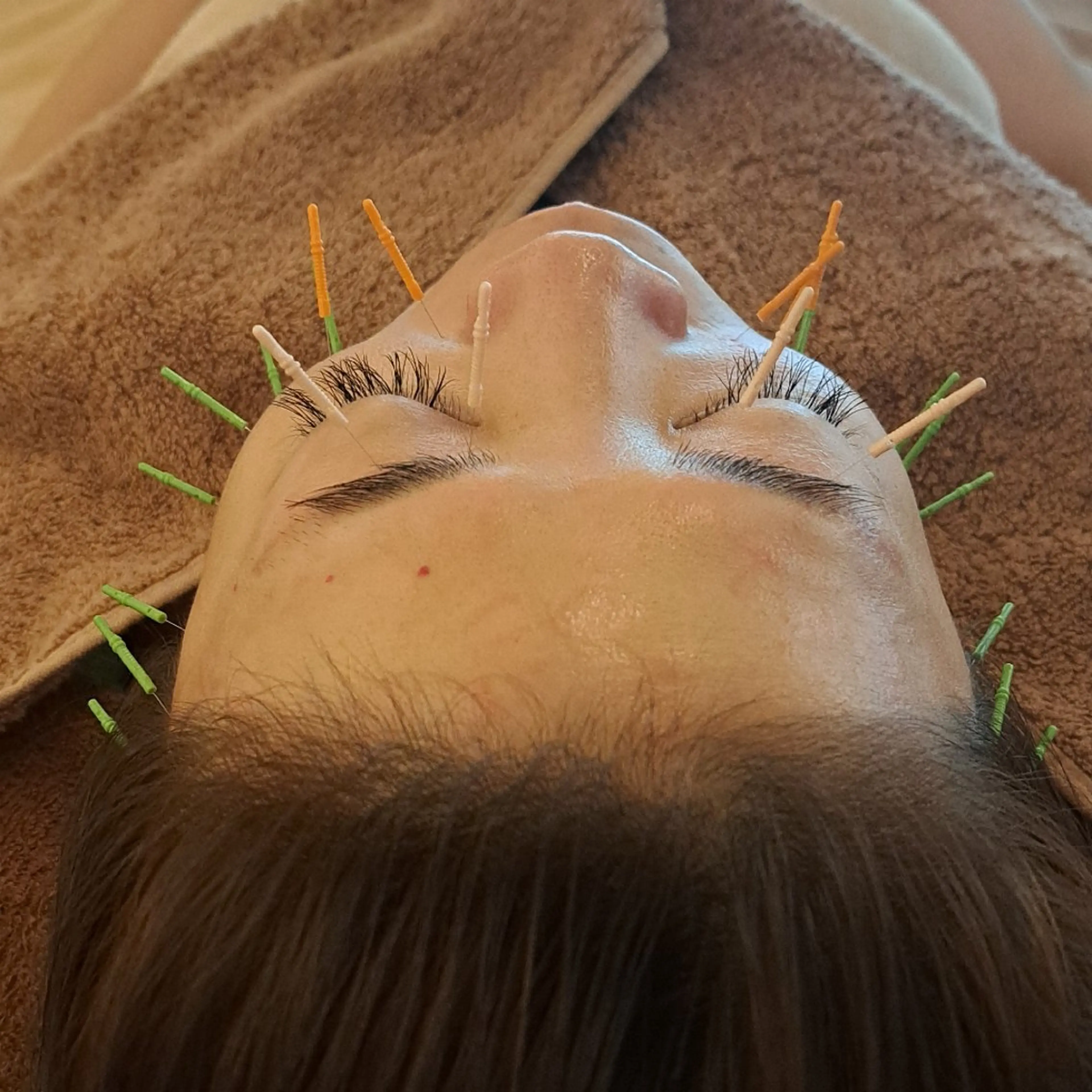 エステ リラク 鍼灸サロンmiyabi所属・美容鍼×エステ 鍼灸 サロンmiyabiのエステ・リラクイメージ