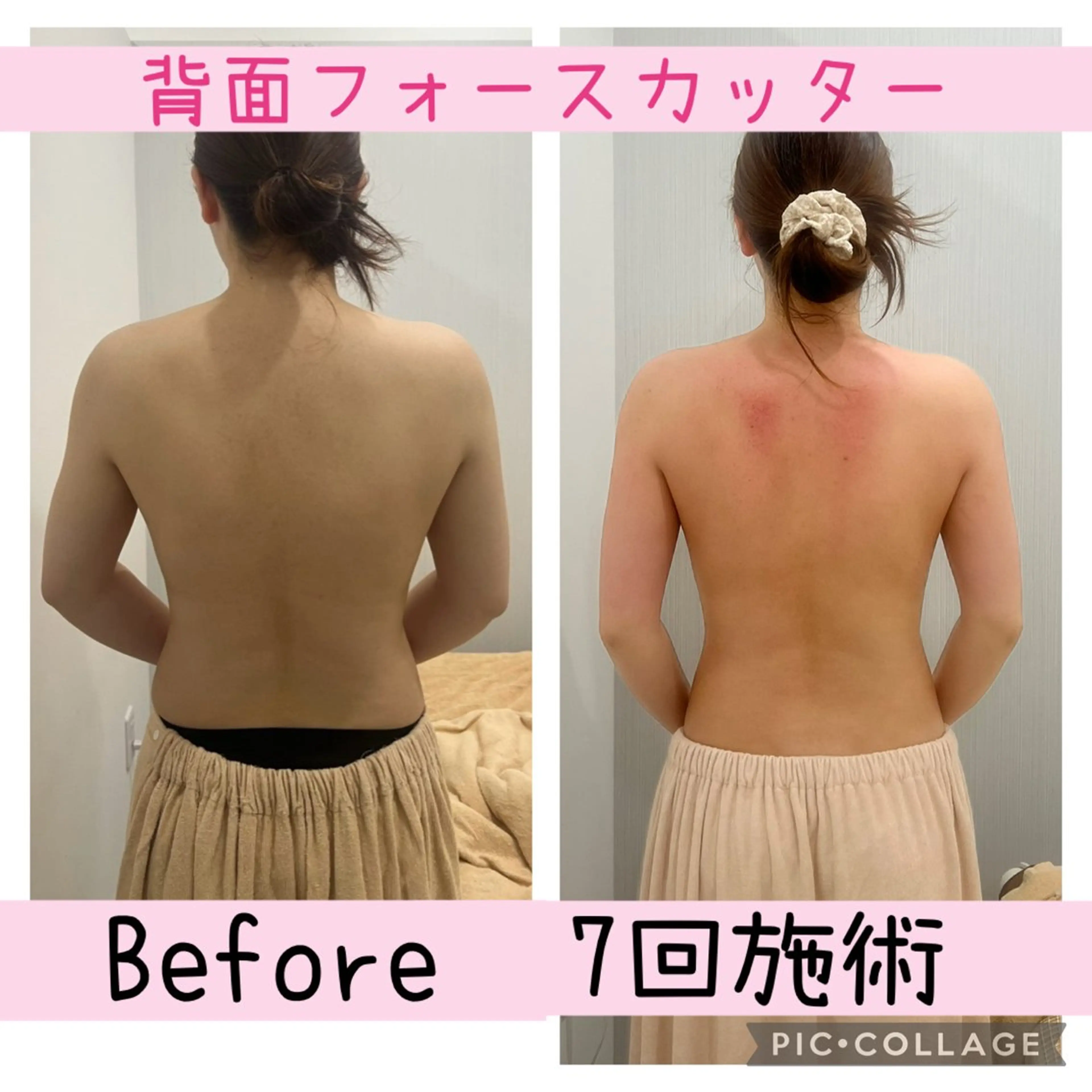 ブライダル痩身×脱毛 尼崎駅前サロンのエステ・リラクイメージ