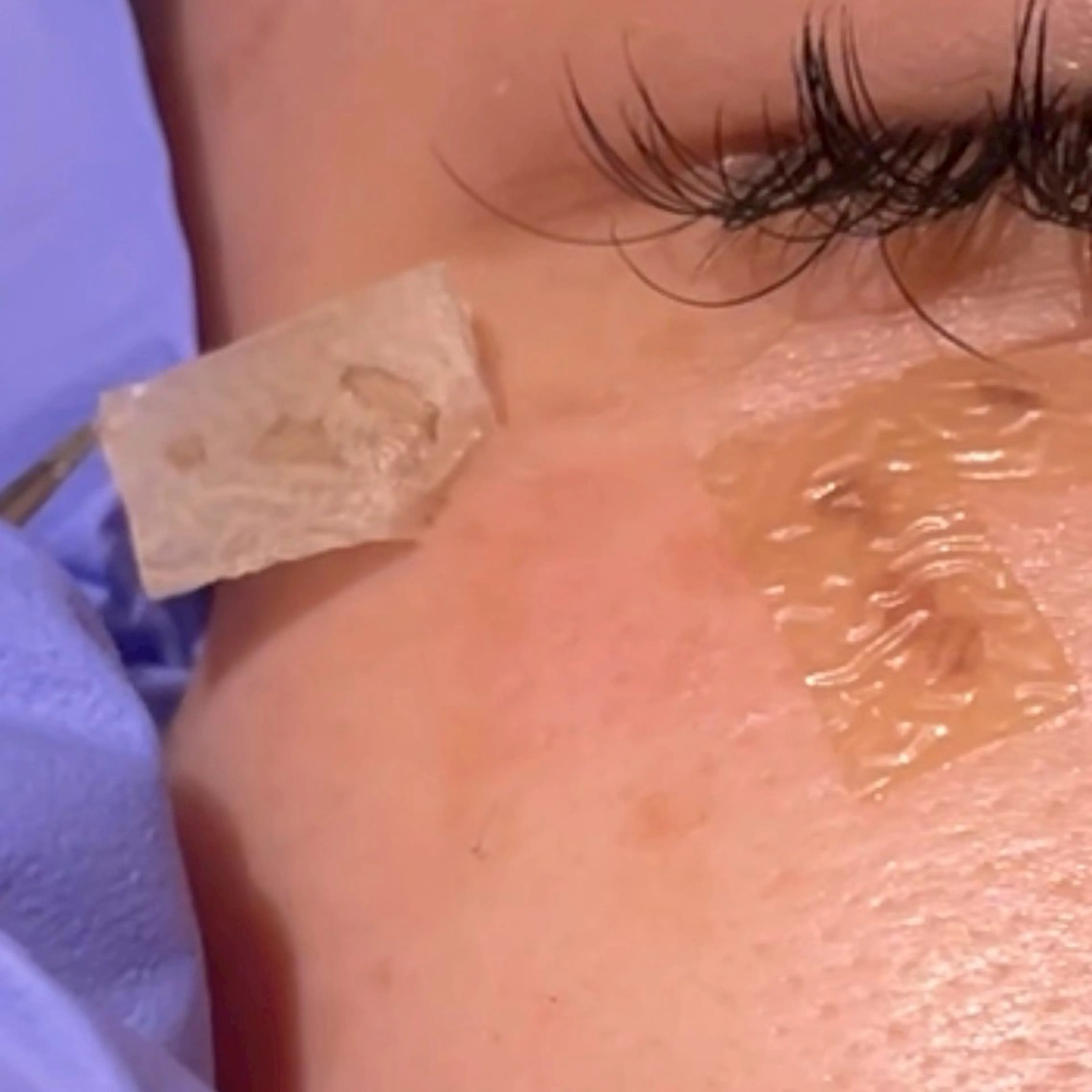 【15分取り放題】機械を使わないシミケア「ホワイトラボ」¥33,000→¥16,500の写真