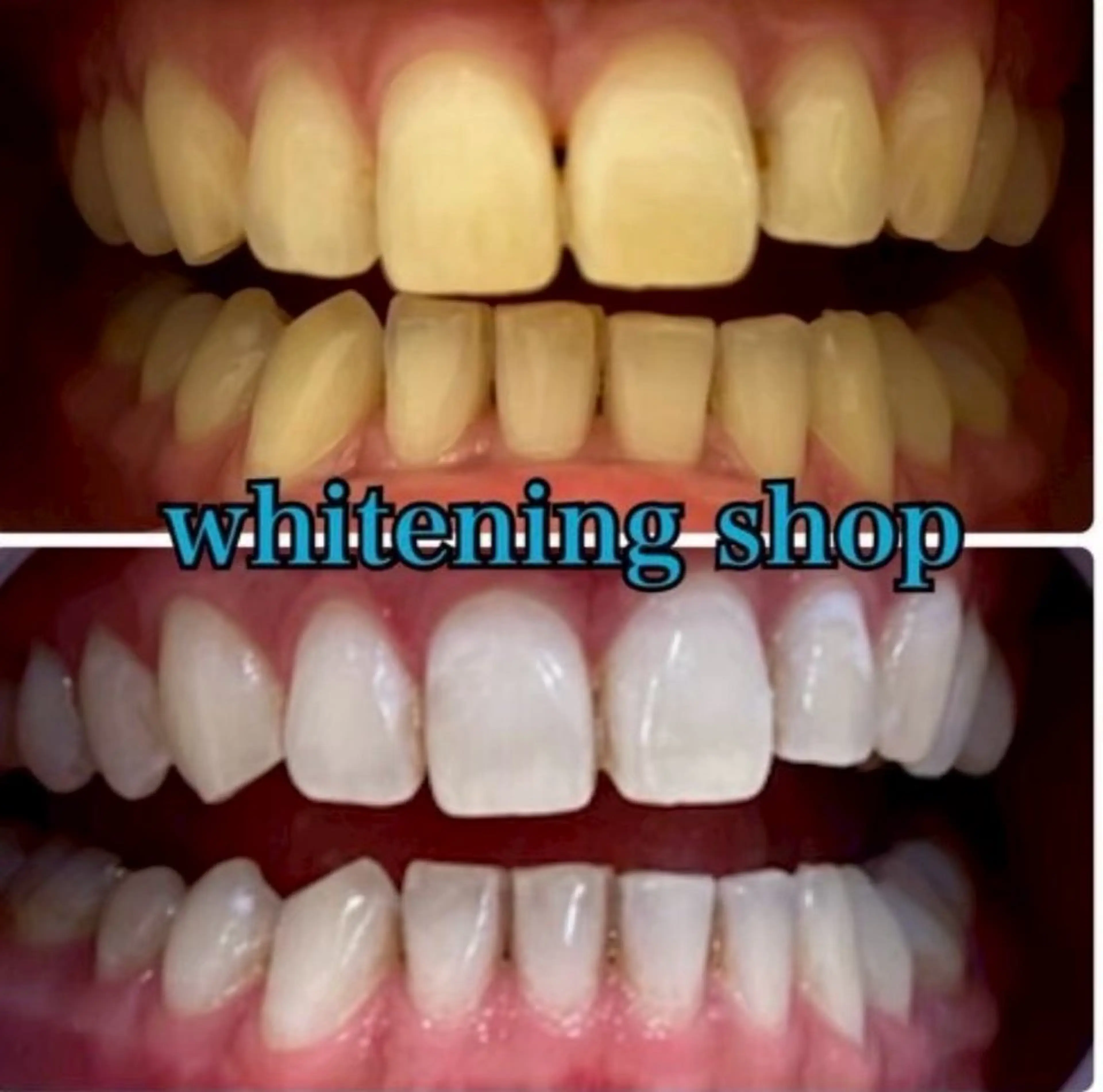 その他 ホワイトニングショップ静岡葵区店所属・ホワイトニング ショップ葵区静岡駅店のその他イメージ