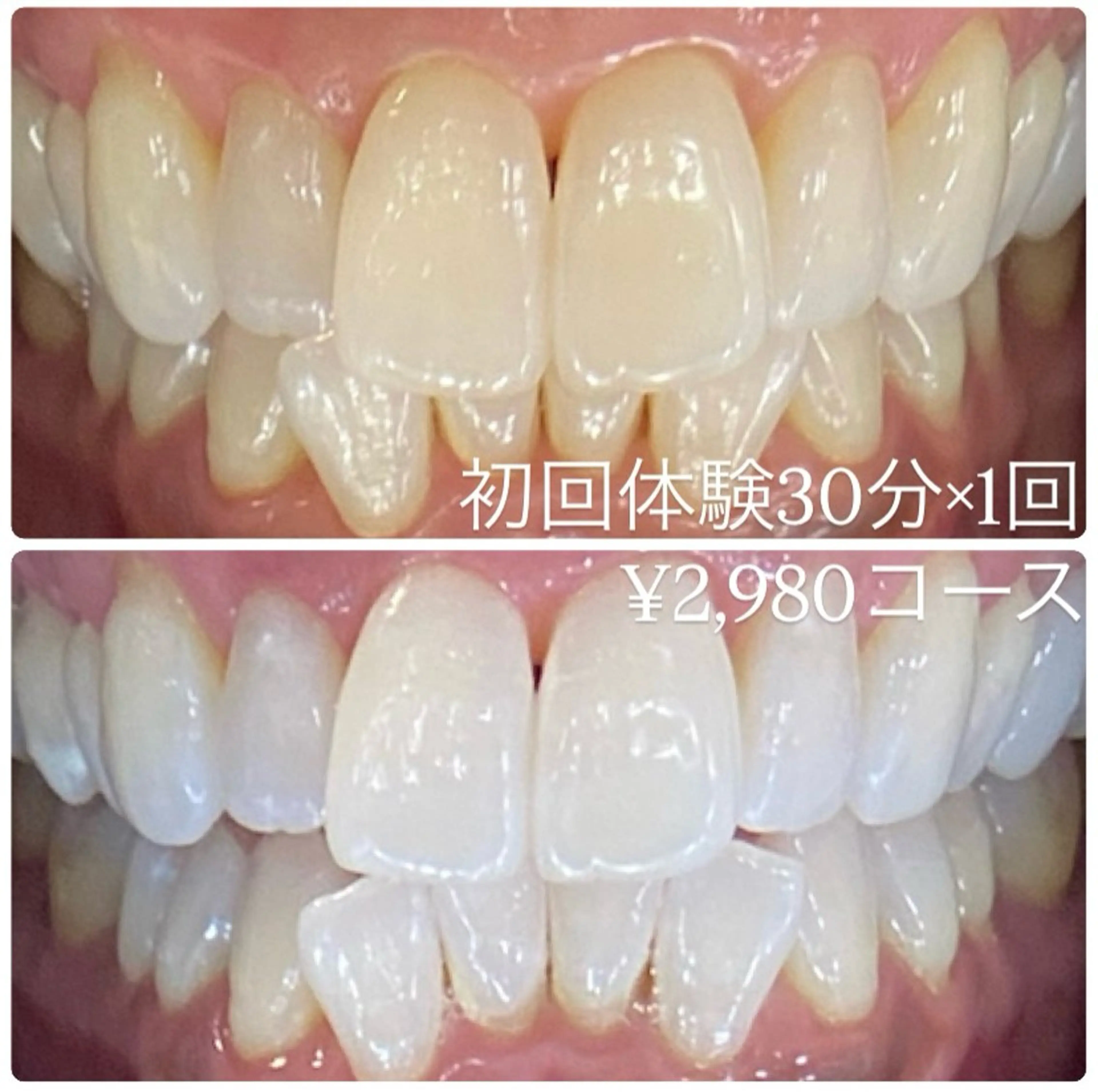 その他 PLATINUM Beauty 横浜店所属・ホワイトニングルーム 横浜店のその他イメージ