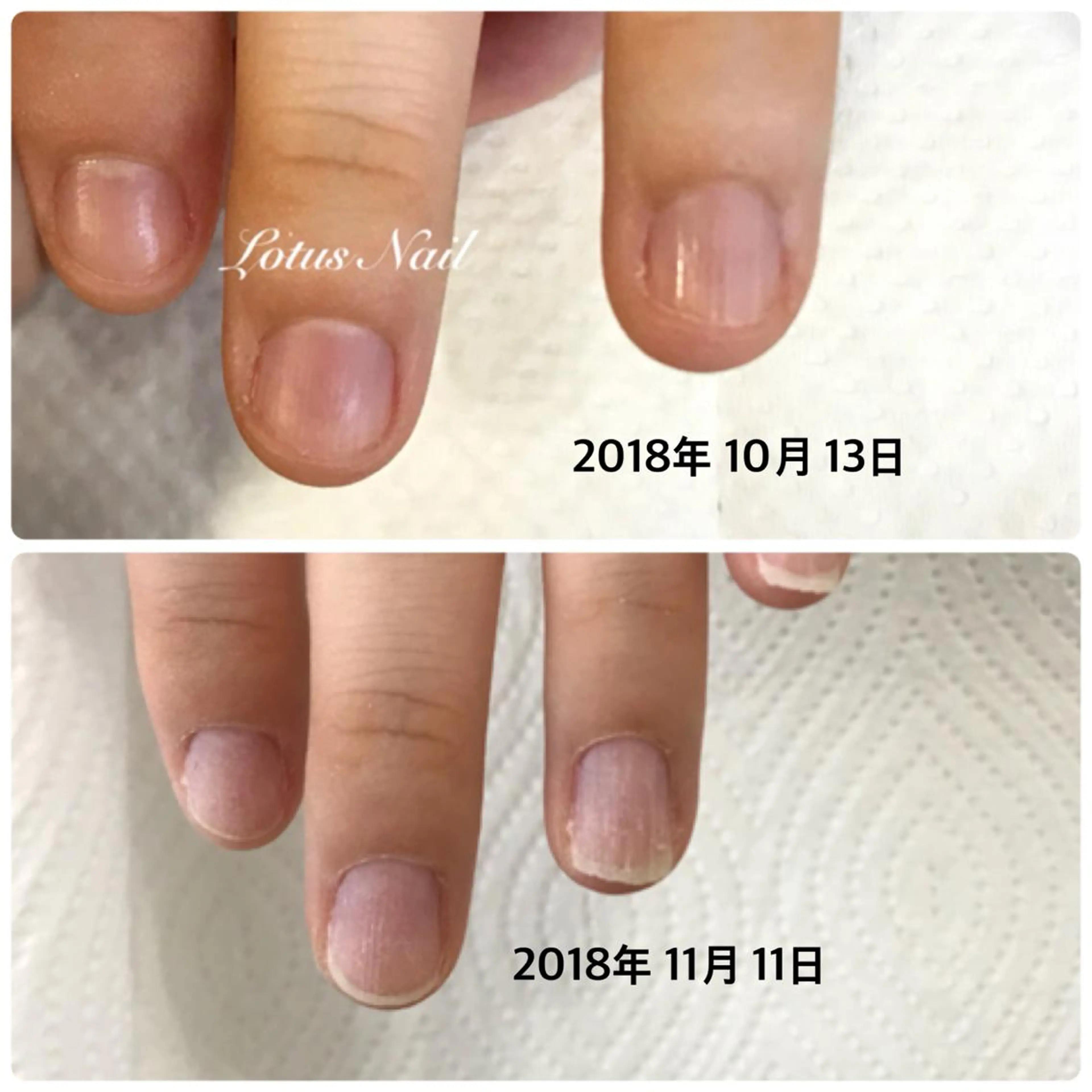 ネイル ハンドネイル Lotus Nailのネイルデザイン