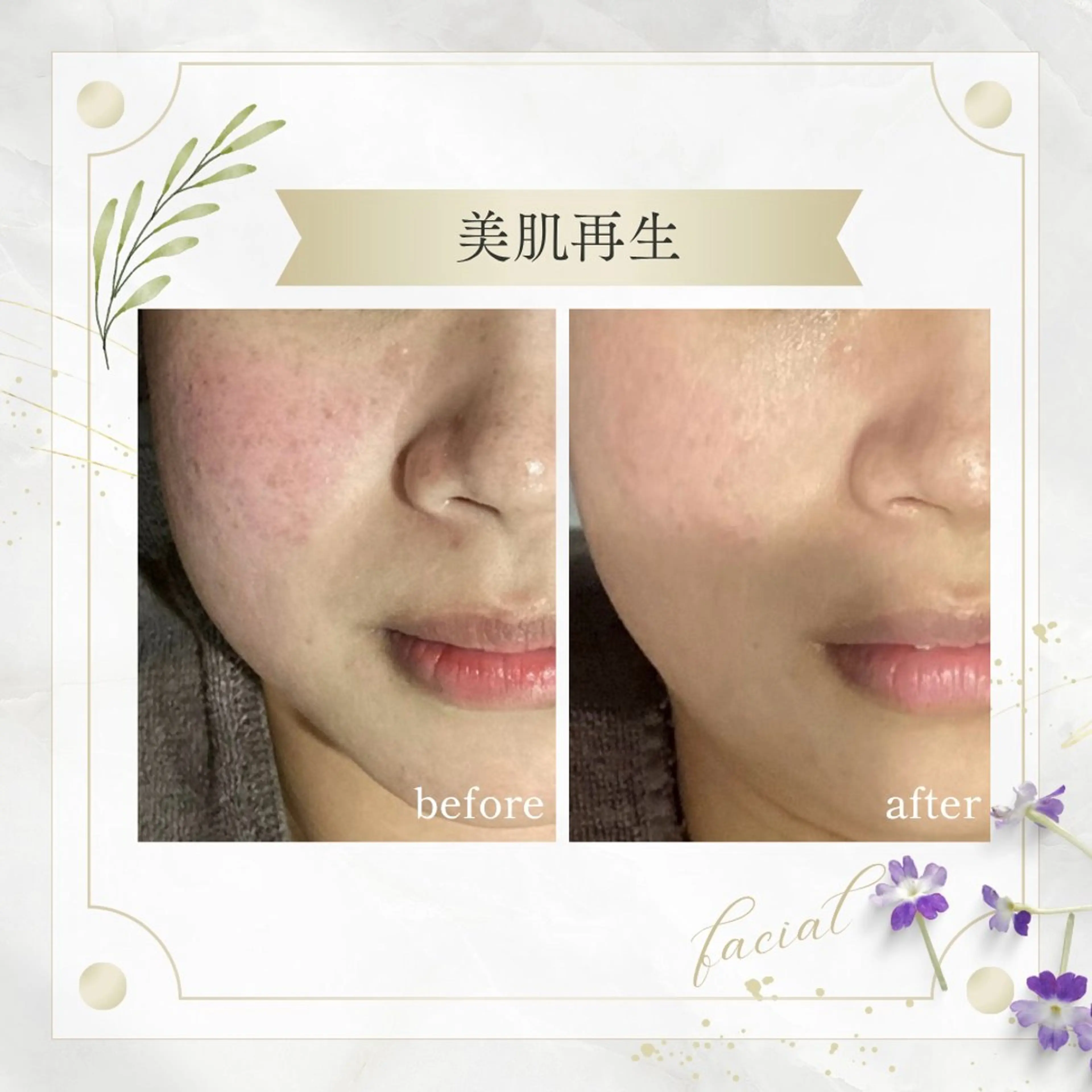 《 肌質×美肌 》 addissimoのエステ・リラクイメージ