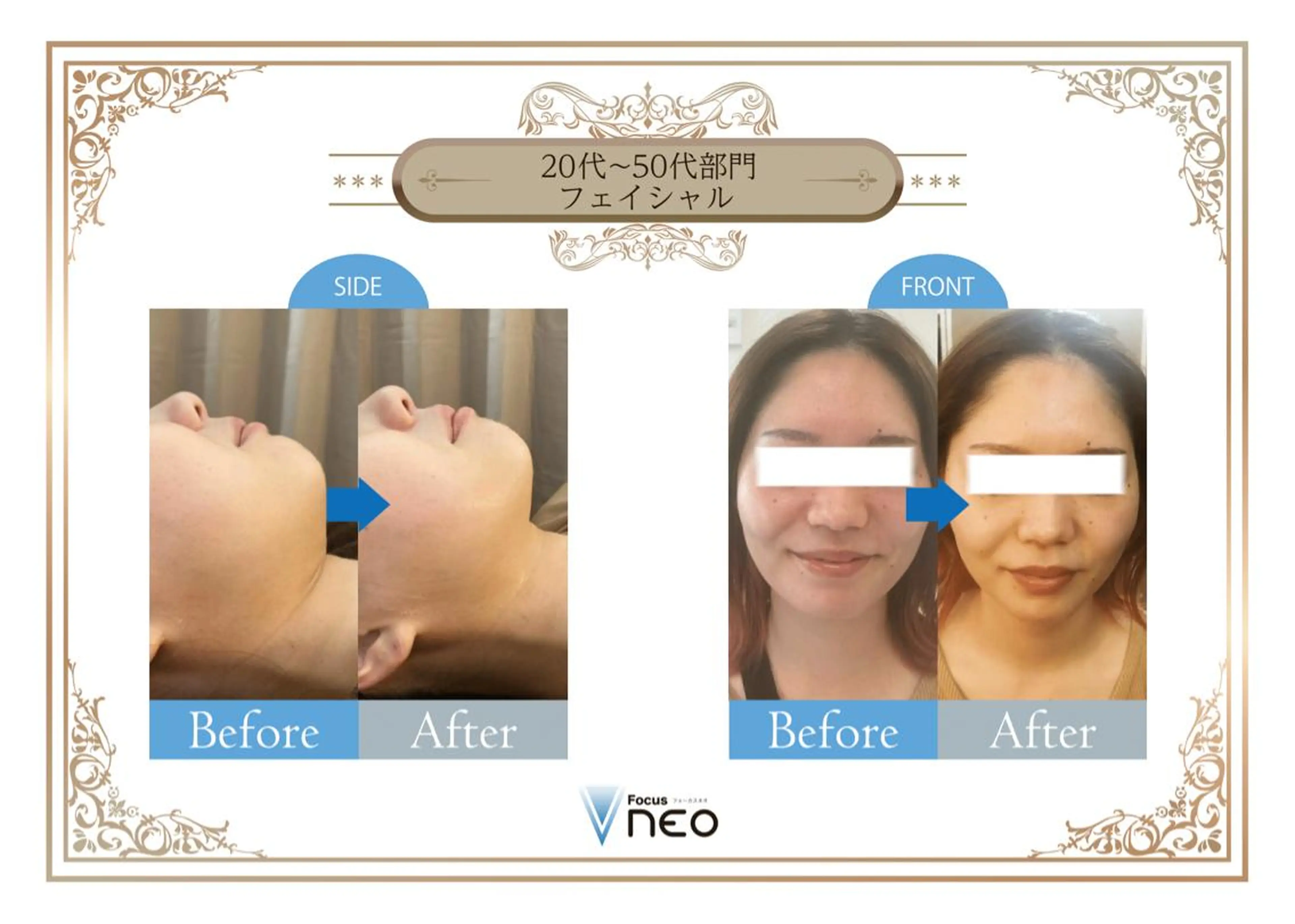 【2回目以降】【小顔✖️美肌マシーン💖4000shot】+パック付きの写真