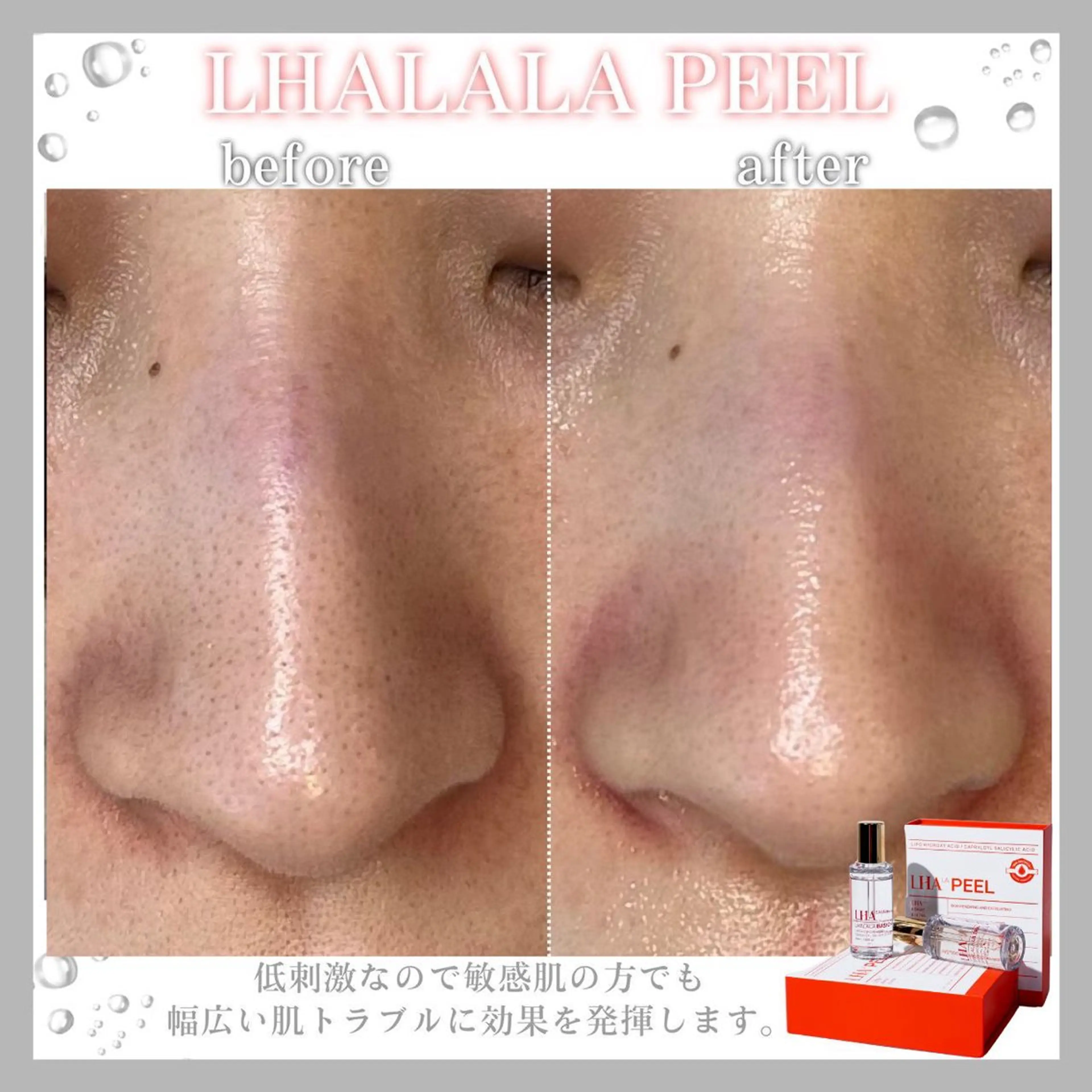 Beauty Salon　Meilily所属・肌質改善サロン Meilily🦋のエステ・リラクイメージ