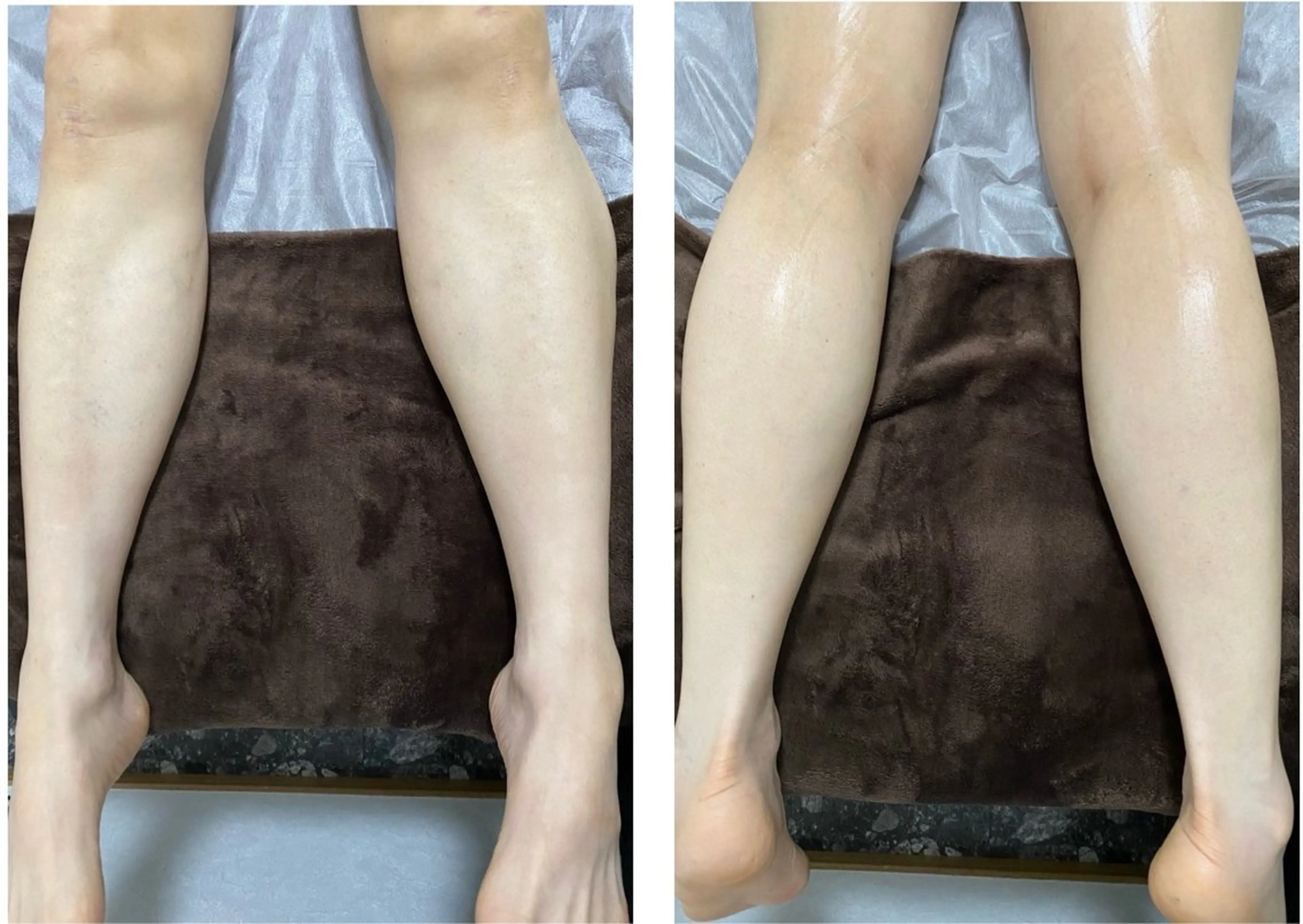 メンズ 脱毛 Lumus Solarum所属・Lumus Solarumのエステ・リラクイメージ