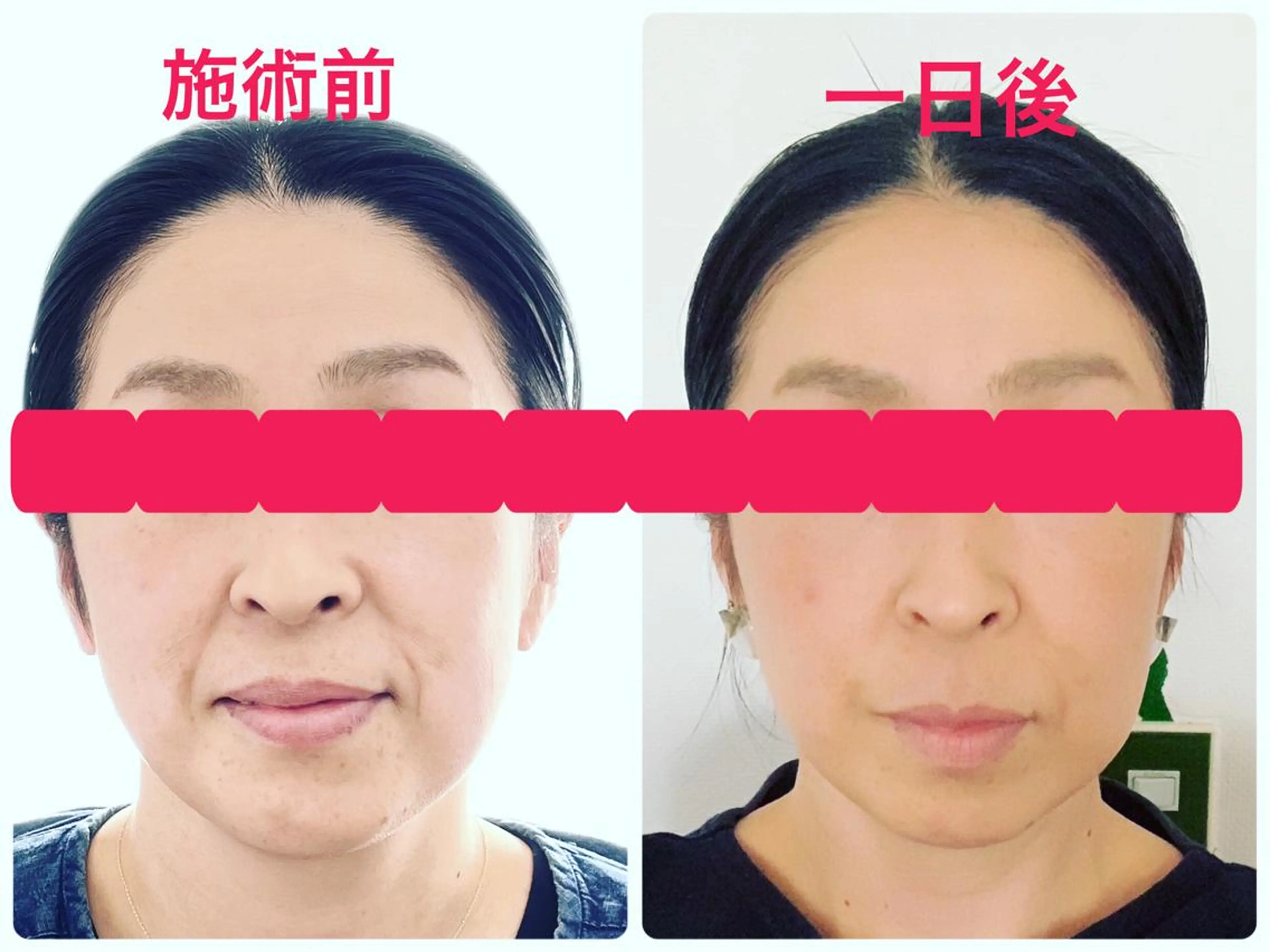 Serapia 【セラピア】のマツエク・マツパデザイン