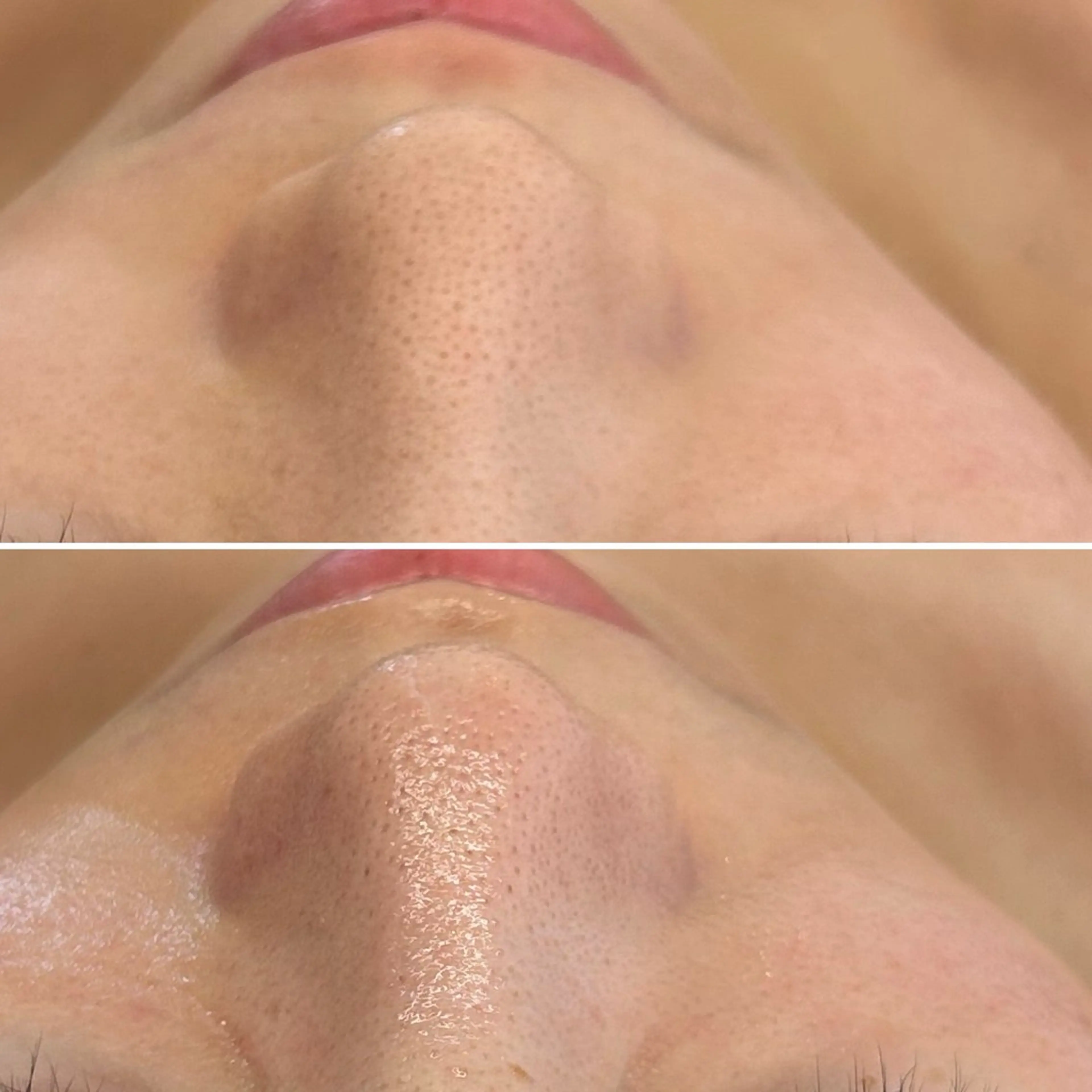 エステ 韓国🇰🇷価格 サロン_Nbibiのエステ・リラクイメージ