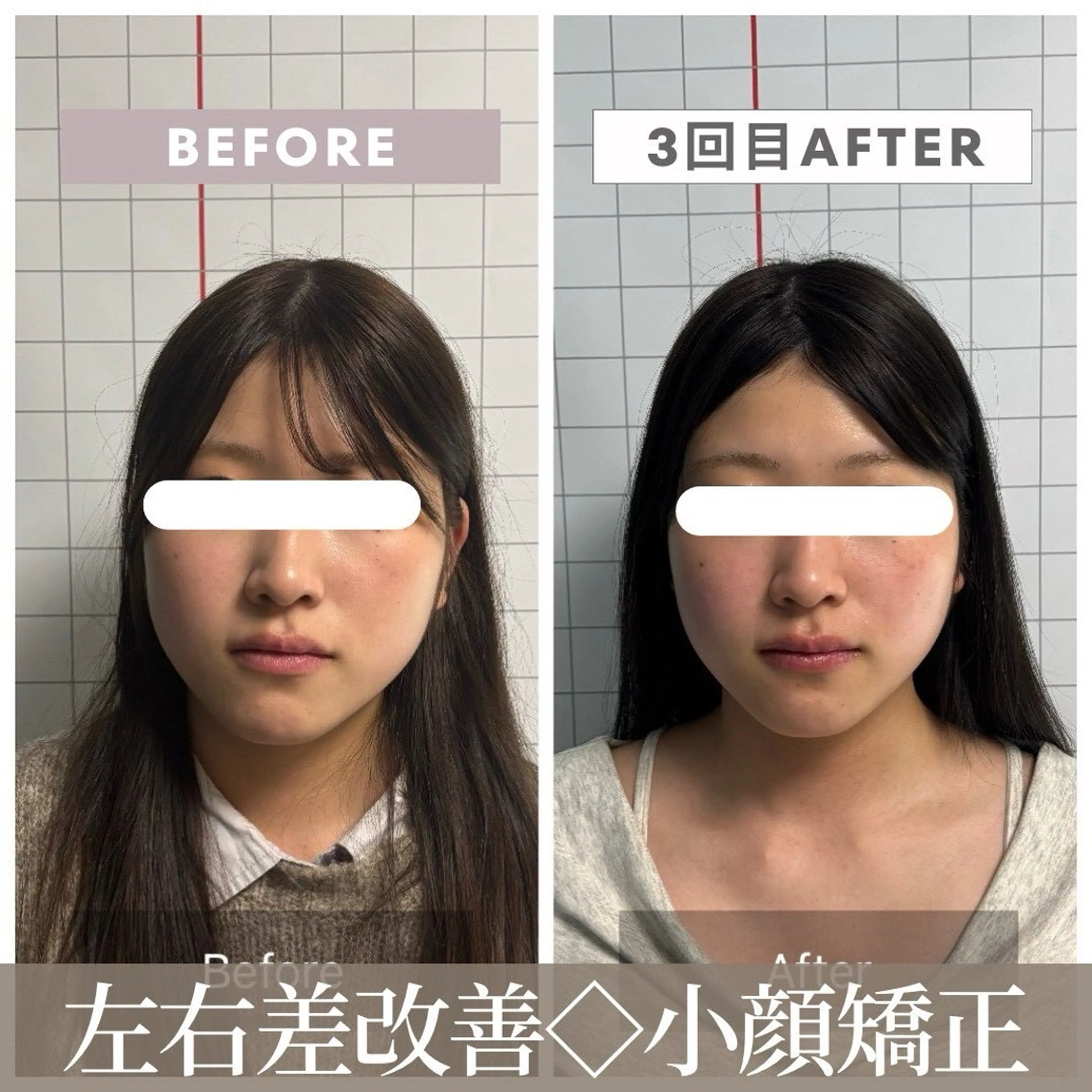 エステ リラク 【小顔リフト×小顔矯正専門店】RED所属・猿渡 ひかるのエステ・リラクイメージ