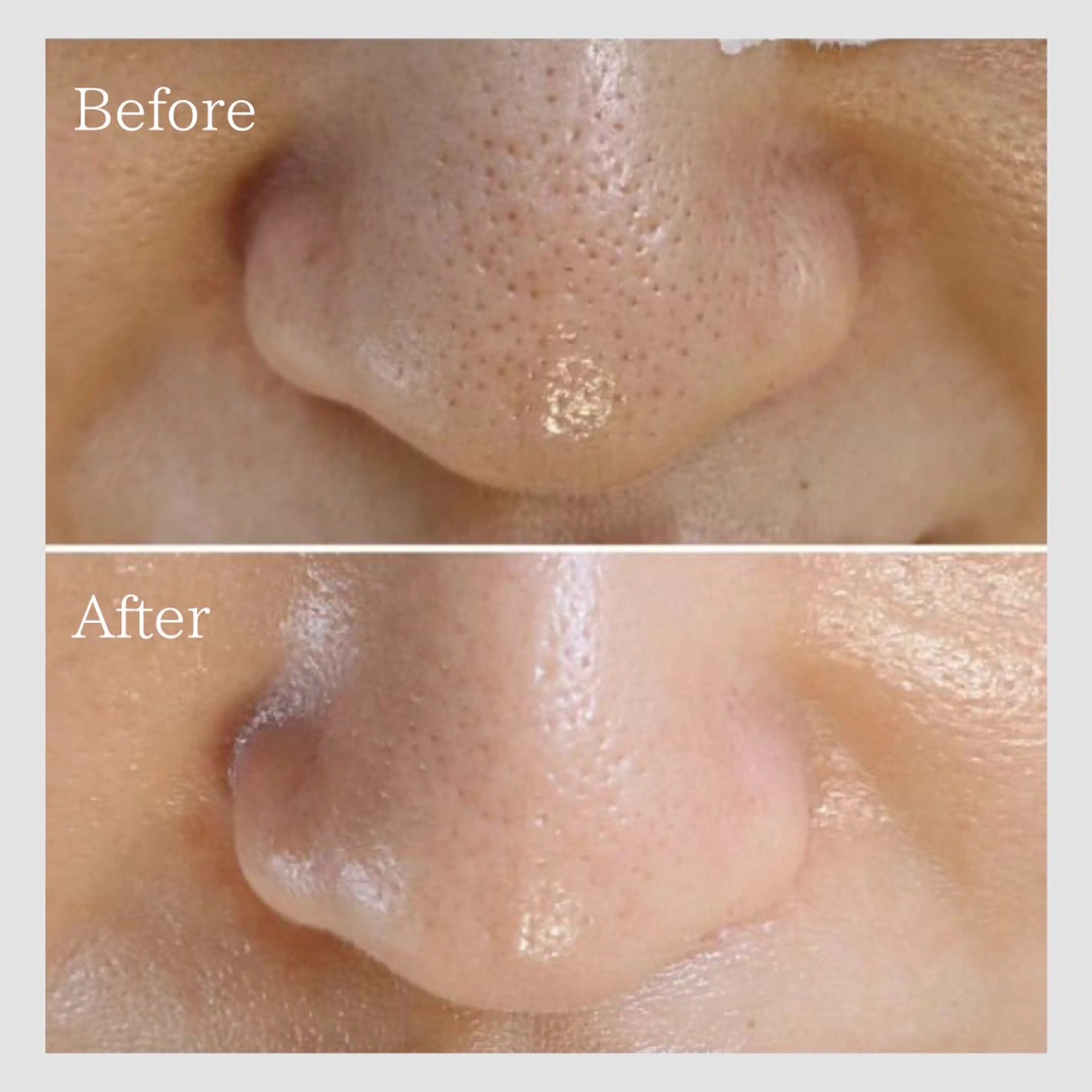 エステ リラク 韓国肌管理 【毛穴専科】のエステ・リラクイメージ