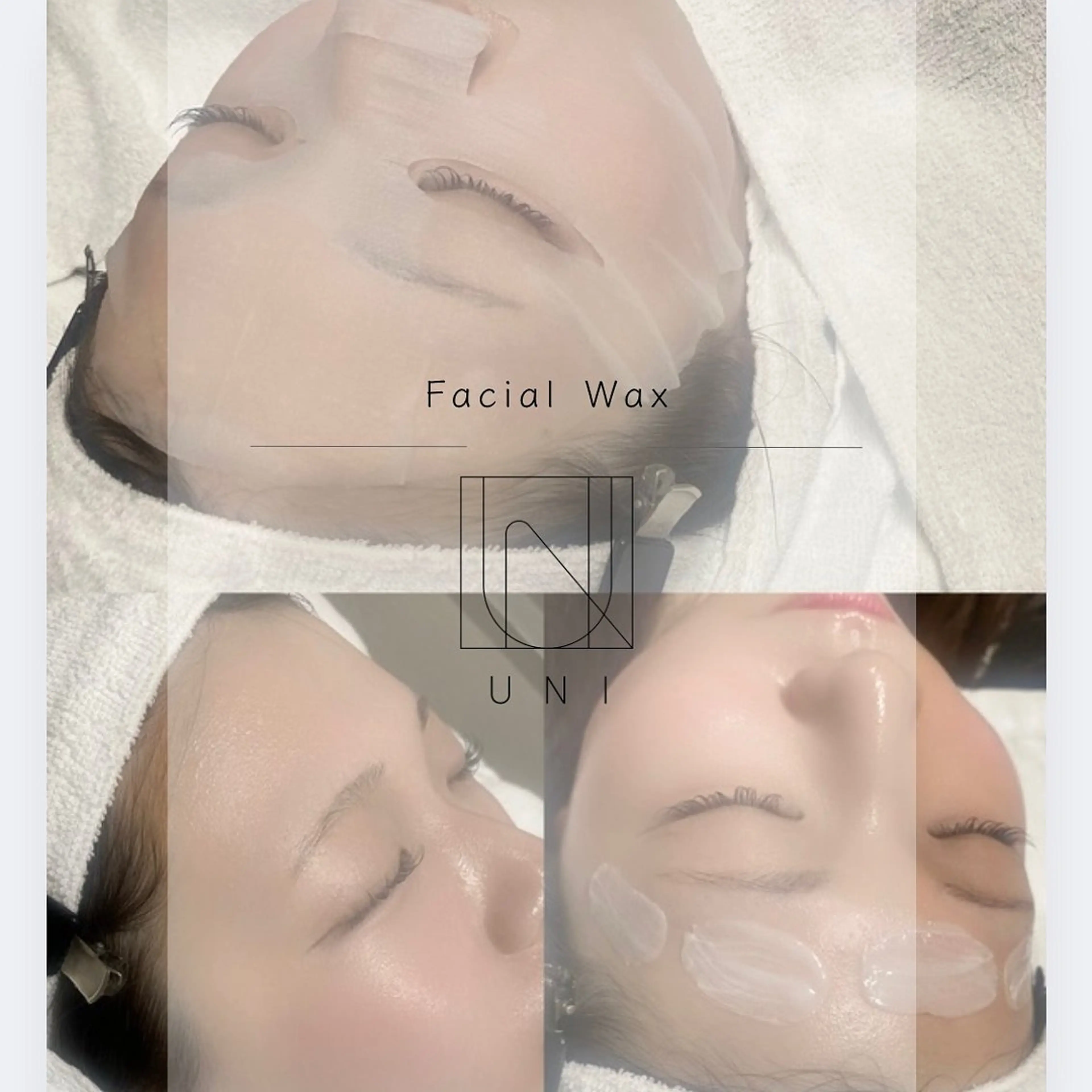 【顔脱毛】話題のフェイシャルワックス ¥4,500の写真