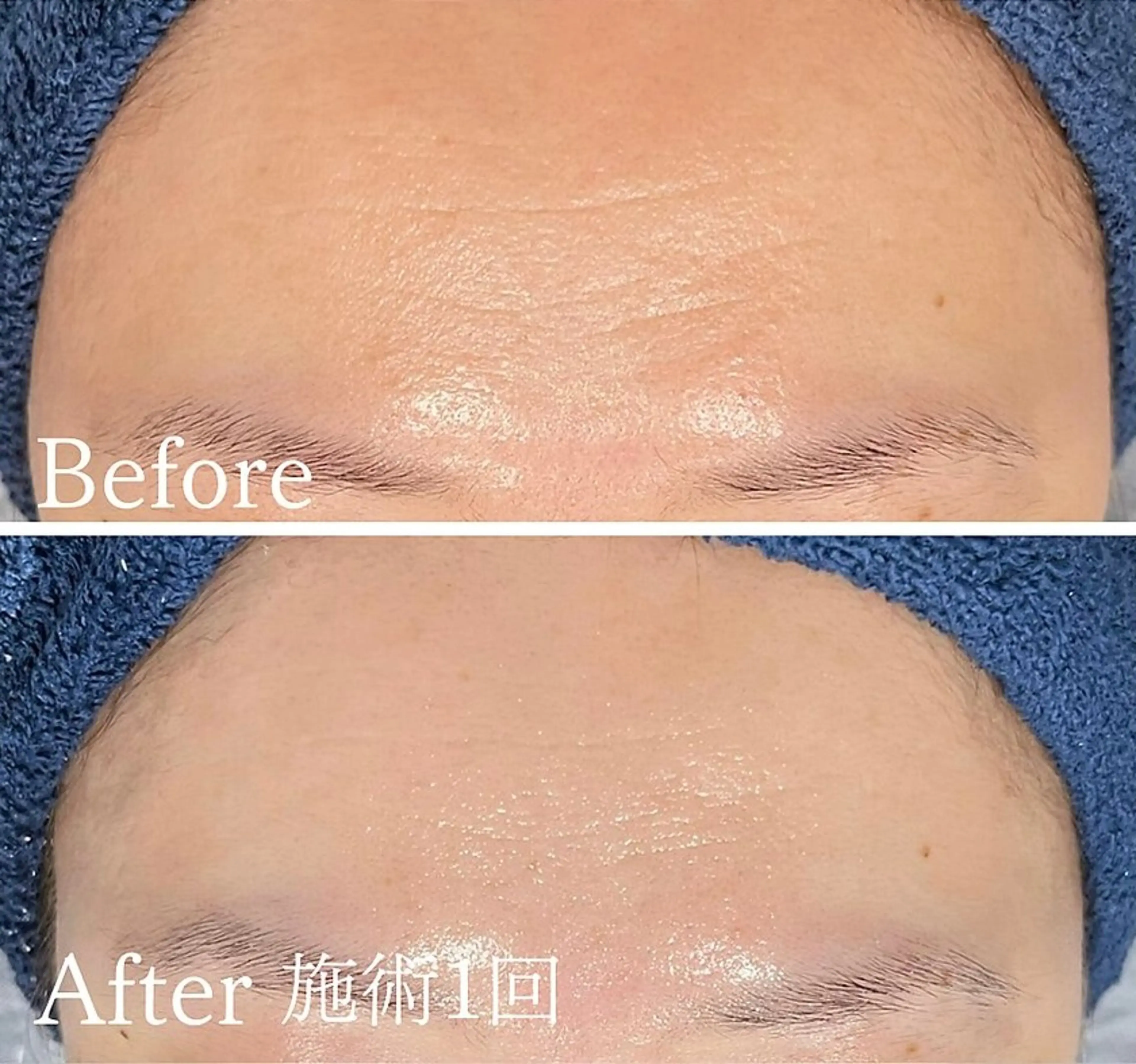 アンド ミルルのエステ・リラクイメージ