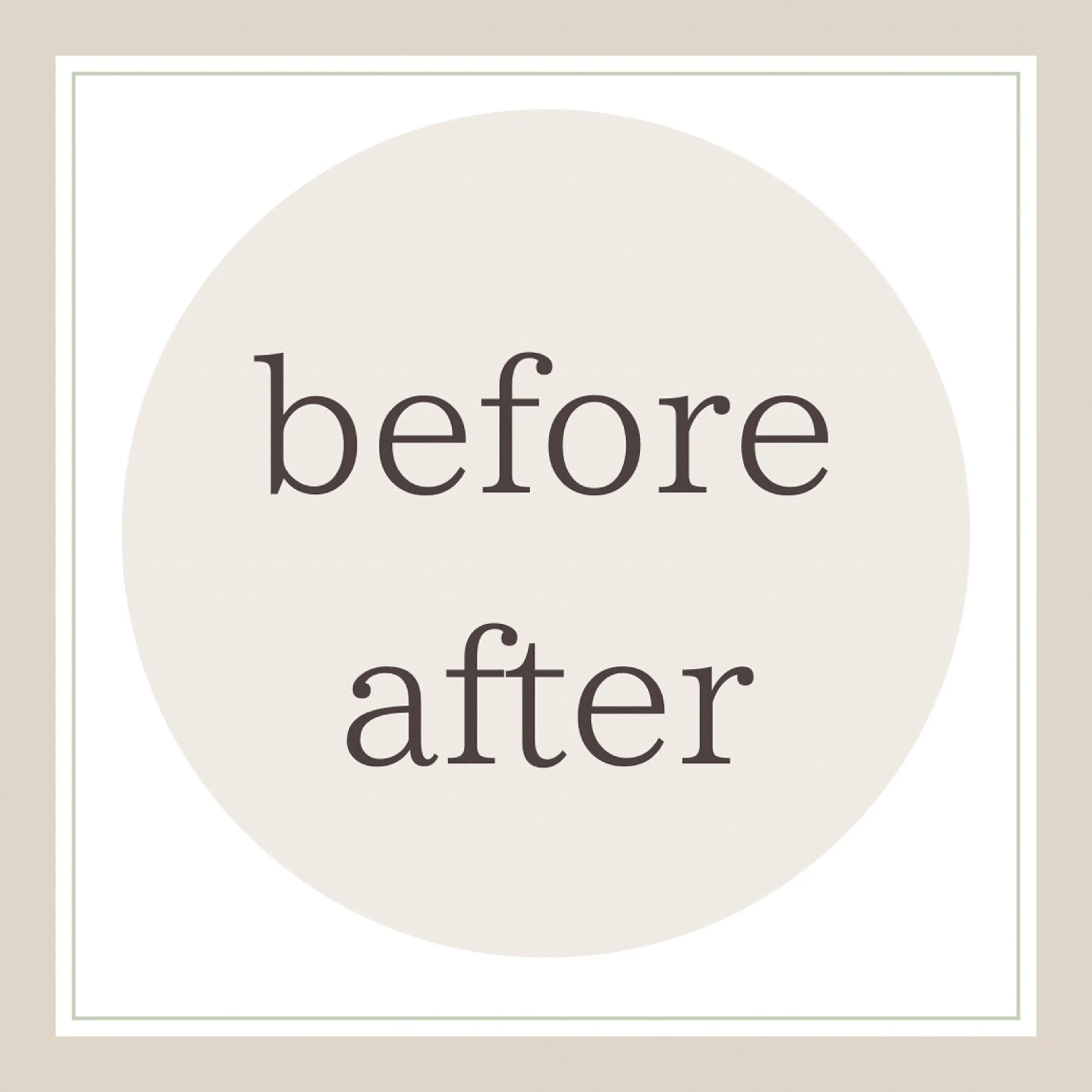 HINANO矢場町店【ヒナノ】所属・脱毛/肌改善🌿 HINANO 村田のエステ・リラクイメージ