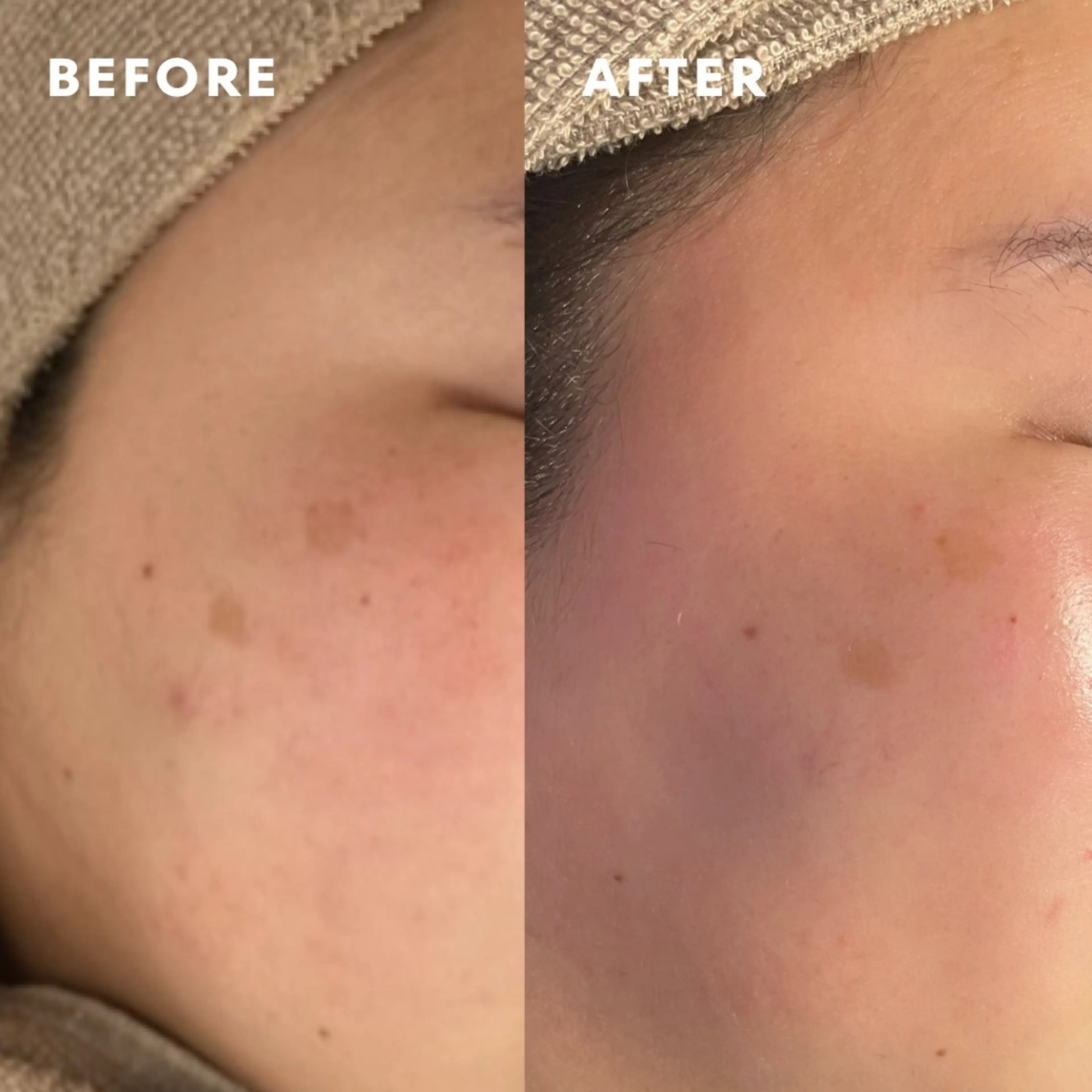 エステ Lassy Yuriの眉毛・アイブロウイメージ