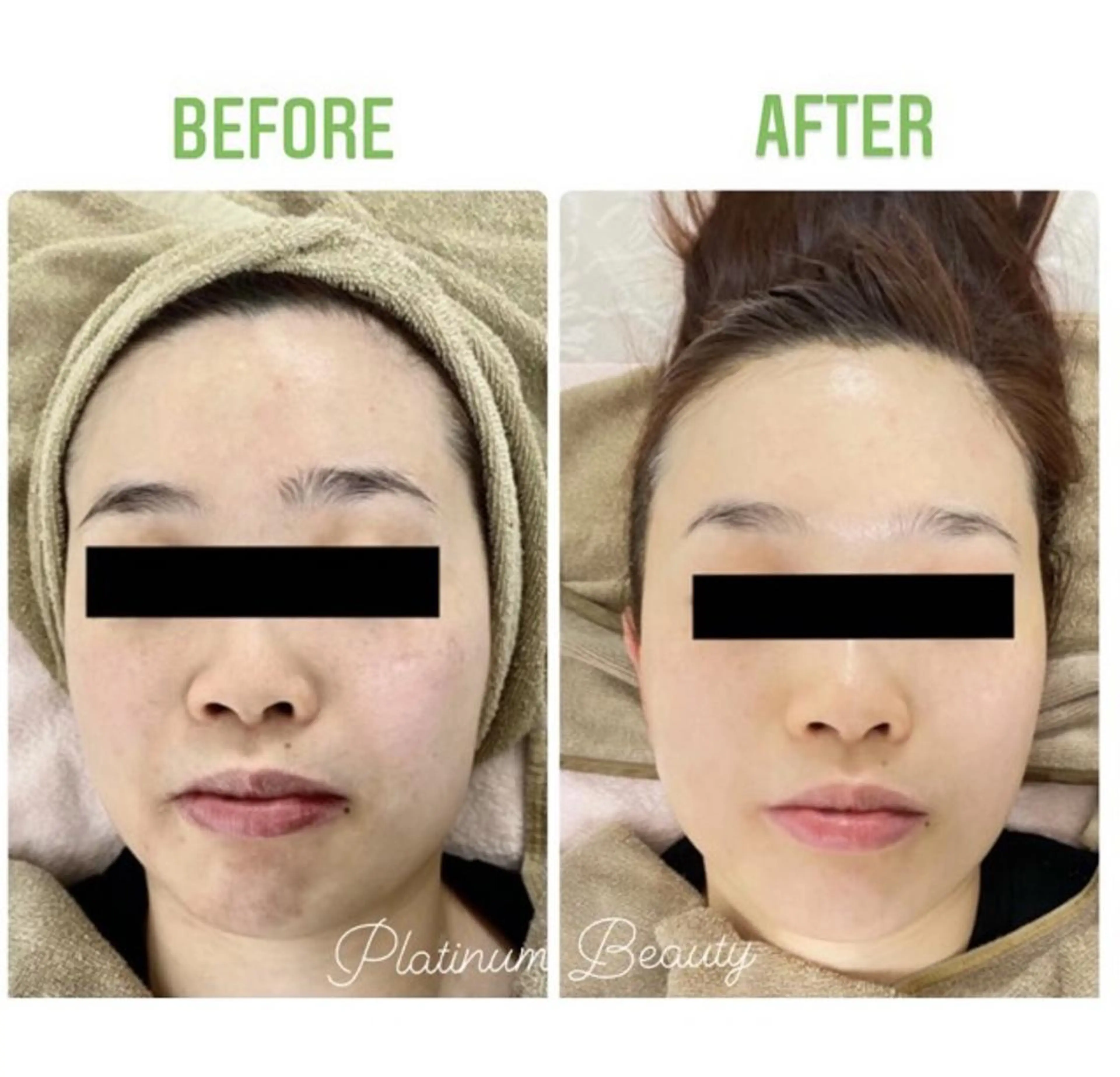 エステ プラティーヌ ボーテ【もものり】のその他イメージ