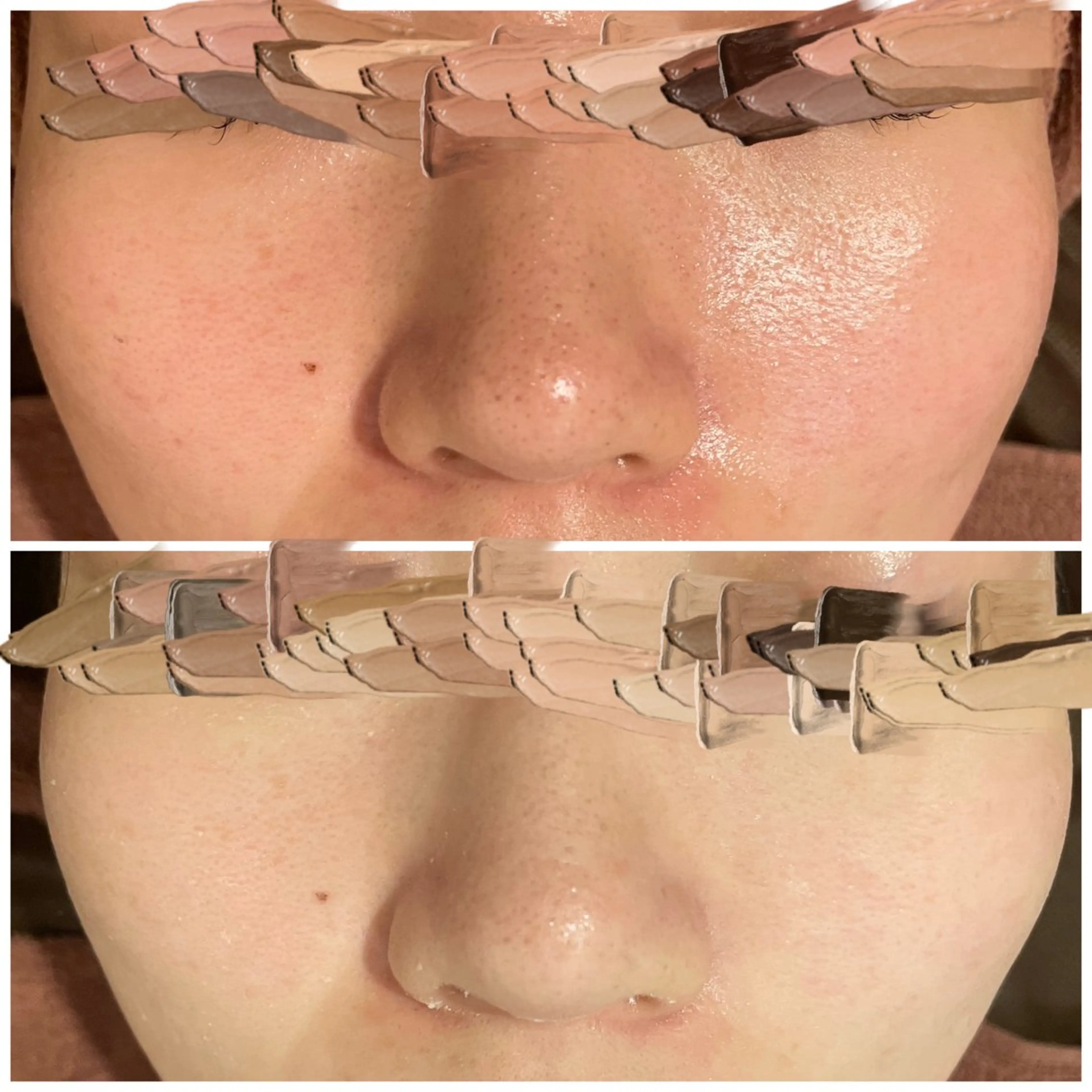 ニキビ特化型エステ 🍓最短で肌質改善のその他イメージ