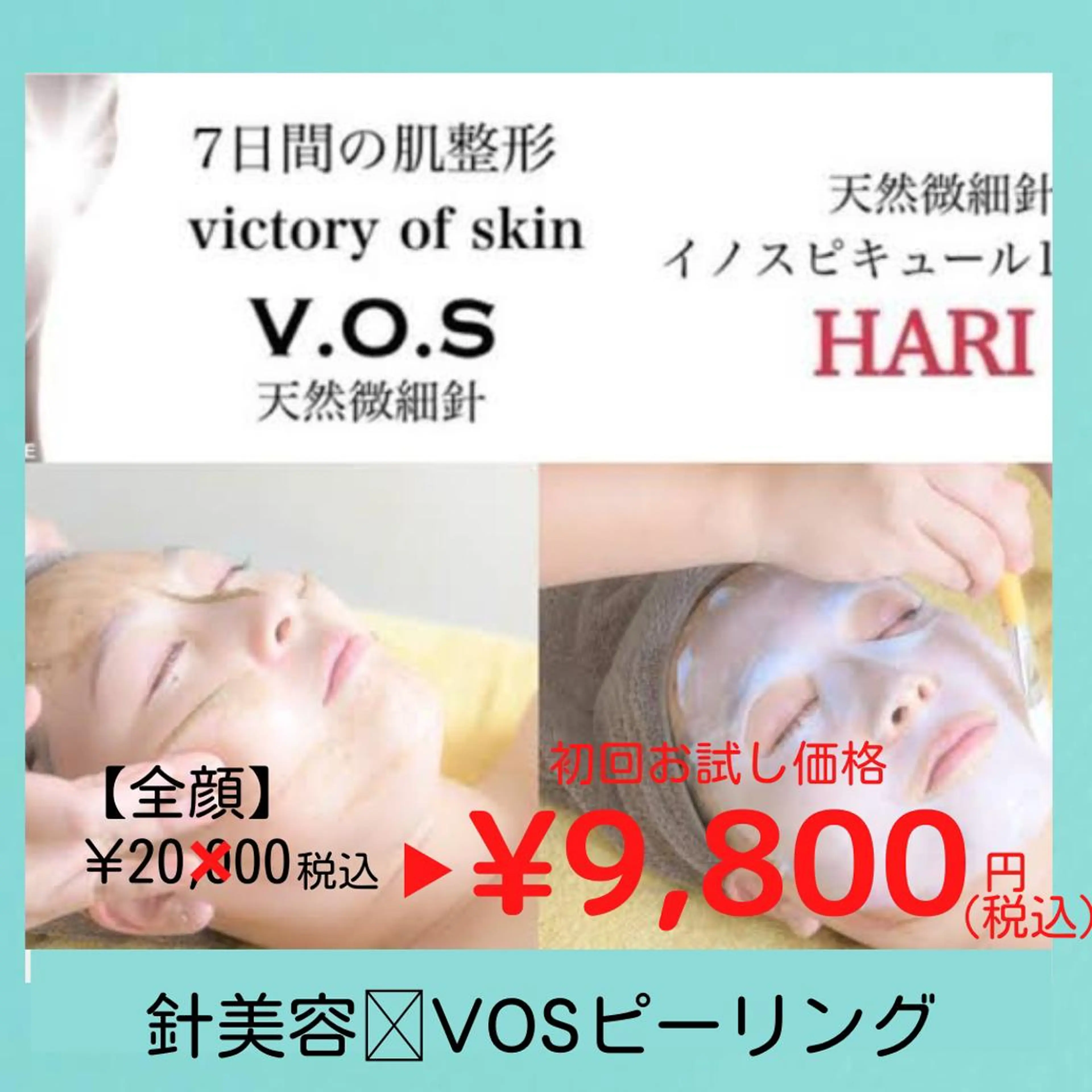 🌹肌改善VOSピーリング/男性可の写真