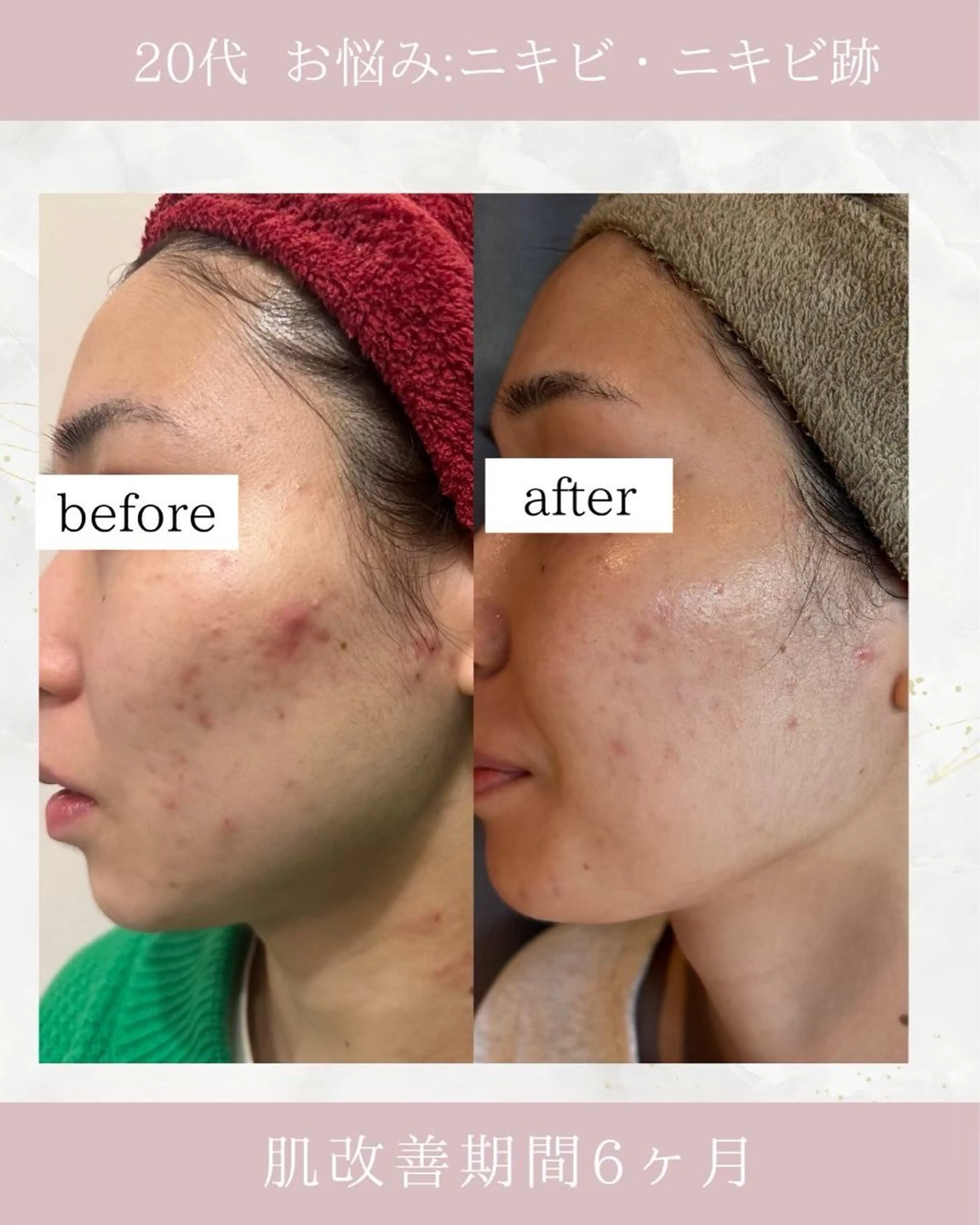 ARuru所属・ARuru 本店のエステ・リラクイメージ