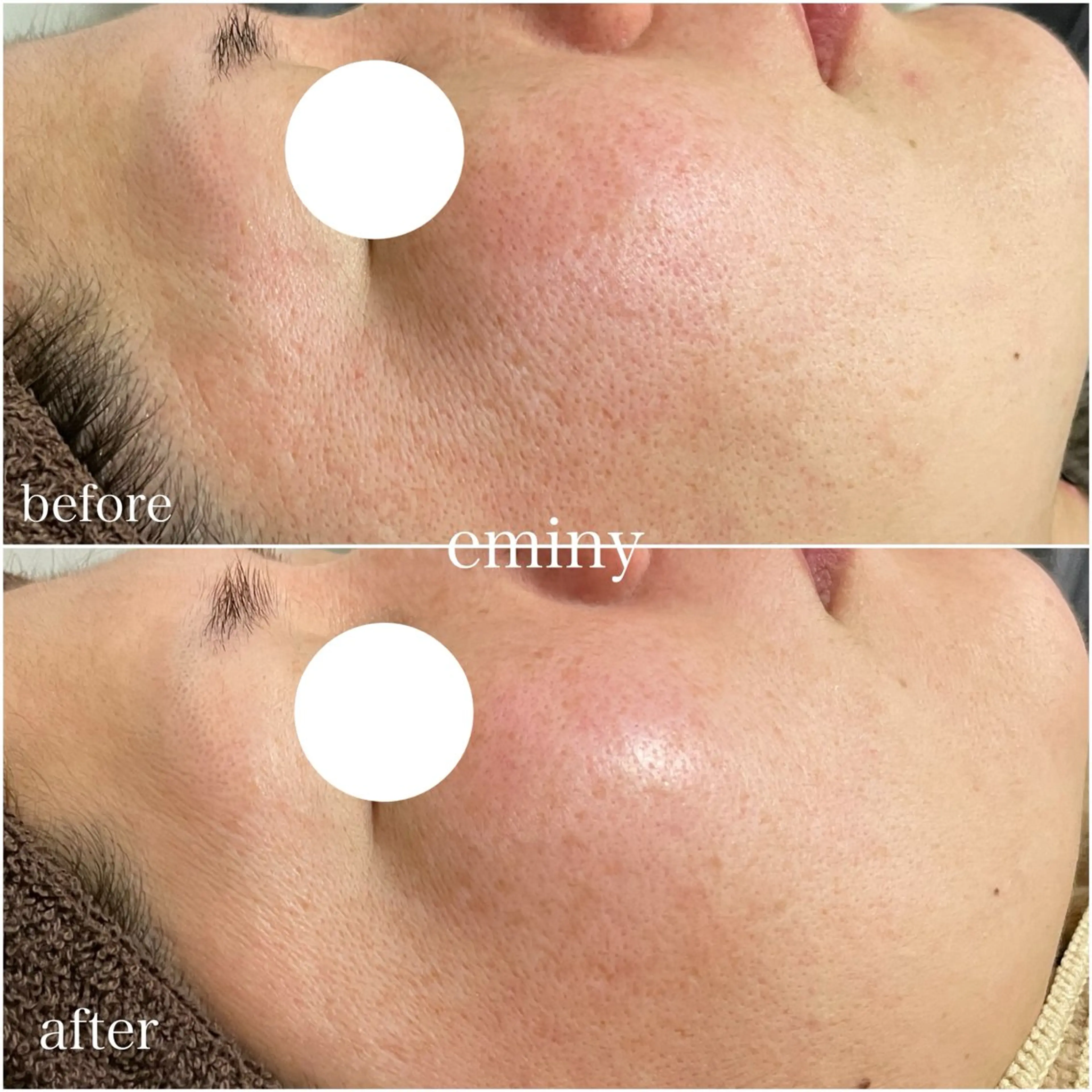 エステ eminy まみのエステ・リラクイメージ