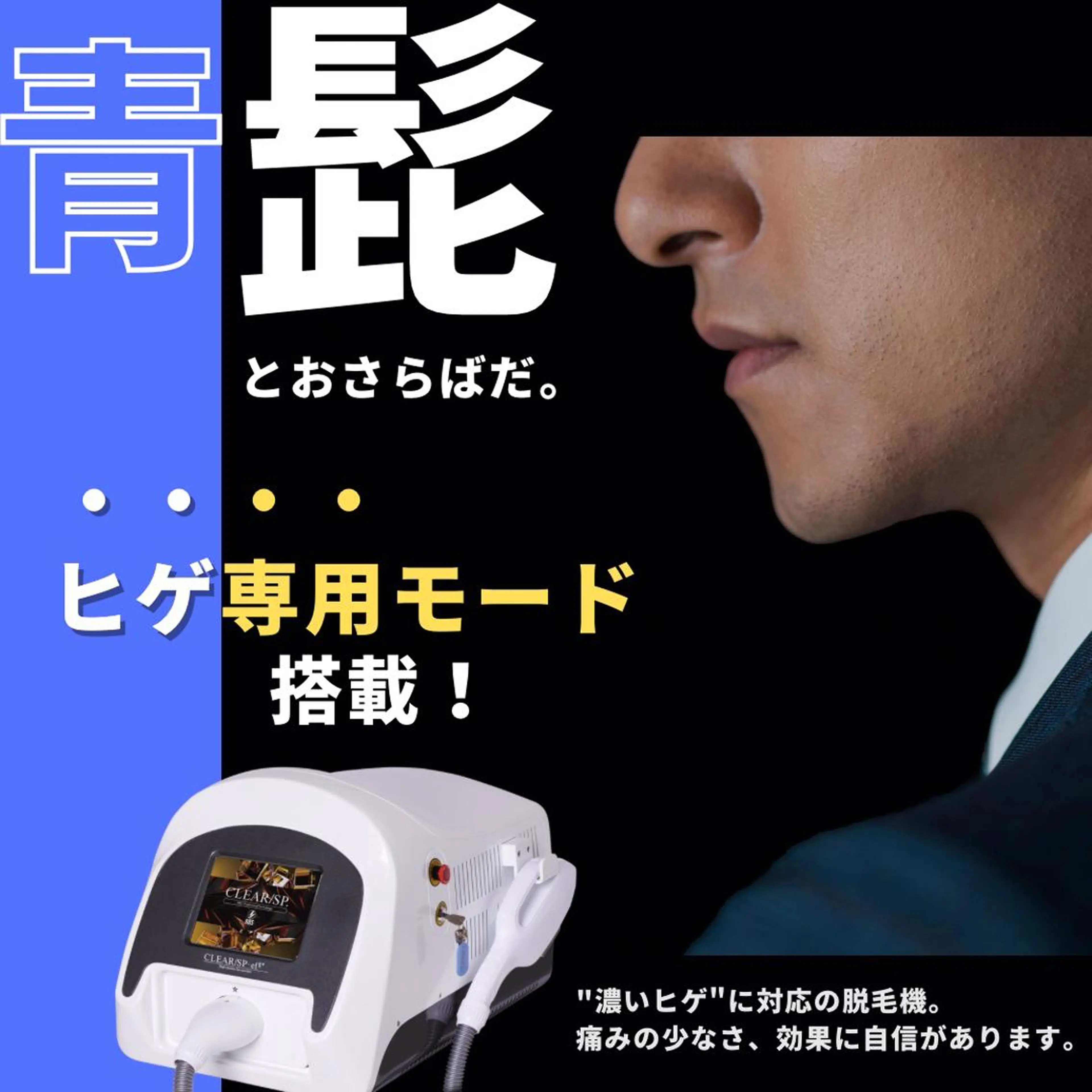 男性　髭脱毛　回数:1回　都度払い　¥9000→¥4900の写真