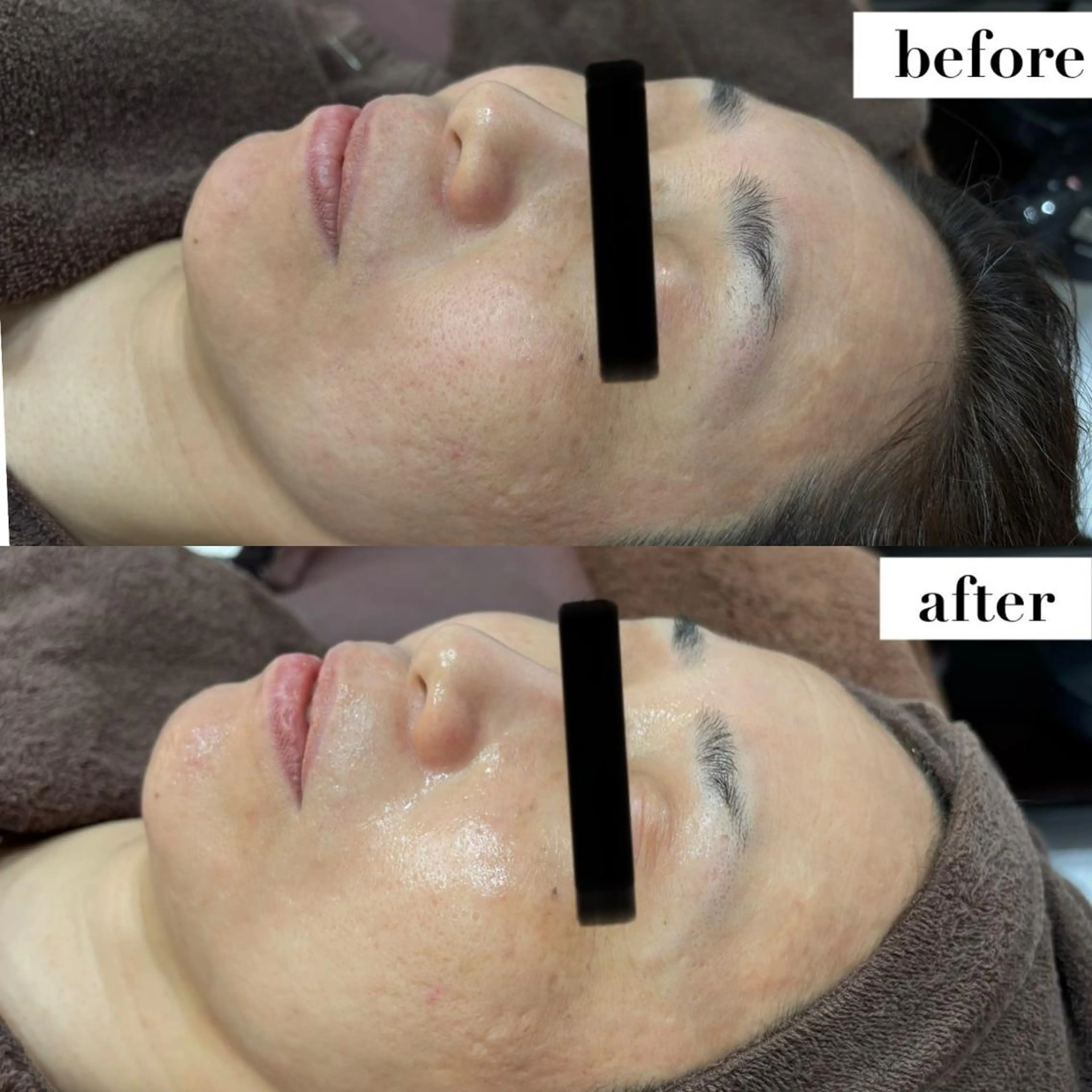 BLESS BEAUTYのエステ・リラクイメージ